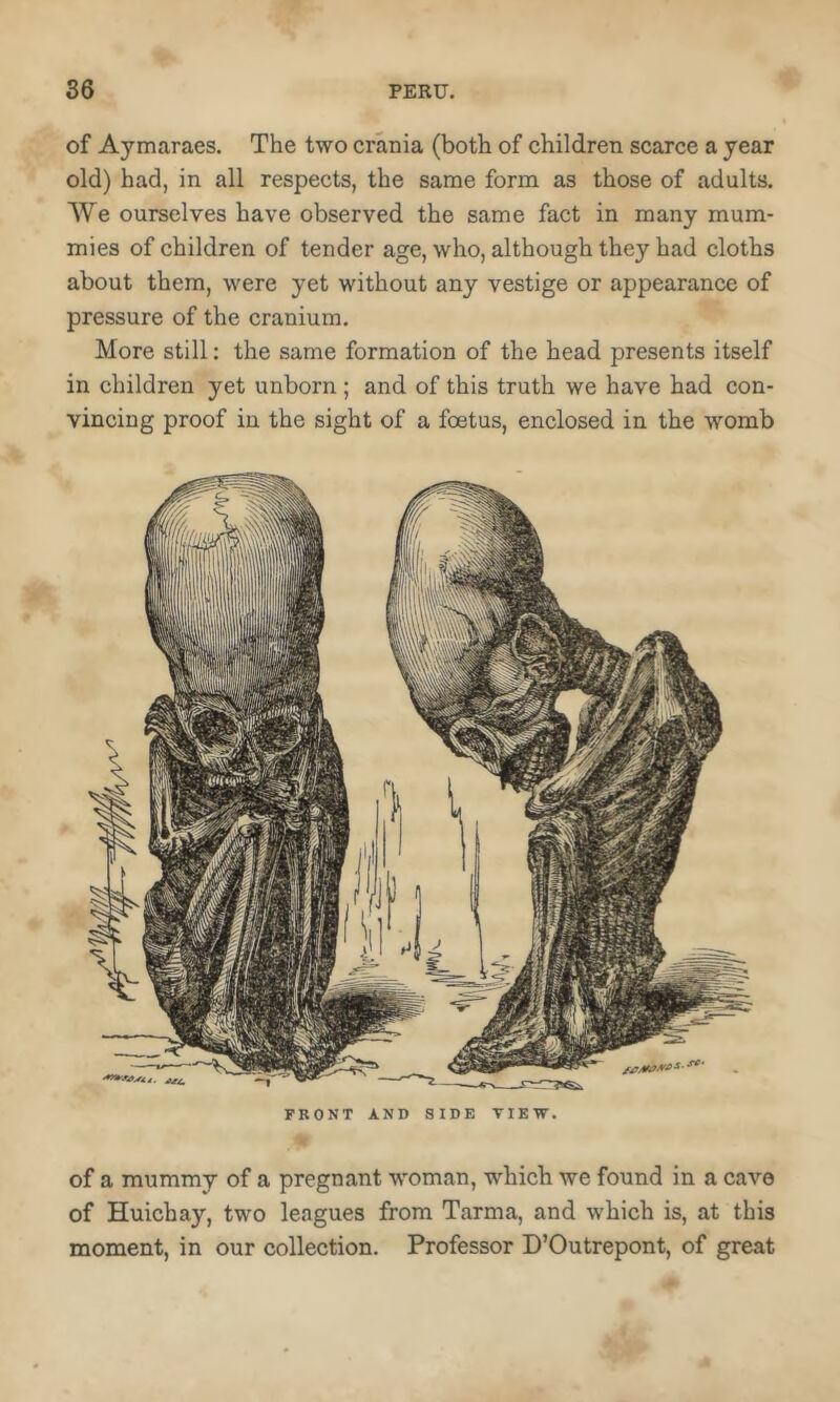 of a mummy of a pregnant woman, which we found in a cave of Huichay, two leagues from Tarma, and which is, at this moment, in our collection. Professor D’Outrepont, of great of Aymaraes. The two crania (both of children scarce a year old) had, in all respects, the same form as those of adults. We ourselves have observed the same fact in many mum- mies of children of tender age, who, although they had cloths about them, were yet without any vestige or appearance of pressure of the cranium. More still: the same formation of the head presents itself in children yet unborn ; and of this truth we have had con- vincing proof in the sight of a foetus, enclosed in the womb