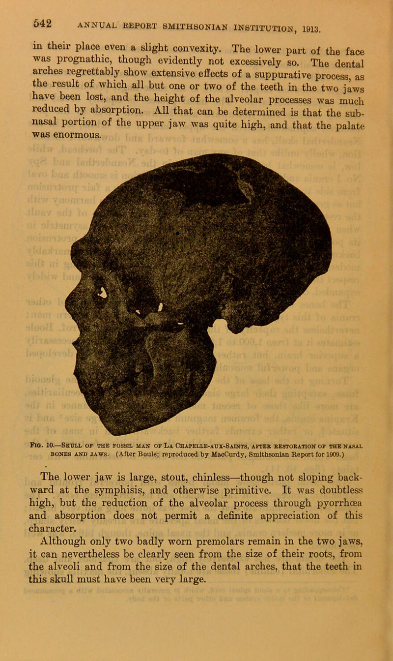 642 in their place even a slight convexity. The lower part of the face was prognathic, though evidently not excessively so. The dental arches regrettably show extensive effects of a suppurative process, as the result of which all but one or two of the teeth in the two jaws have been lost, and the height of the alveolar processes was much reduced by absorption. All that can be determined is that the sub- nasal portion of the upper jaw was quite high, and that the palate was enormous. Pig. 10.—Skull of the fossil man of La Chapelle-aux-Saints, after restoration of the nasal BONES AND JAWS. (After Boule; reproduced by MacCurdy, Smithsonian Report for 1909.) The lower jaw is large, stout, chinless—though not sloping back- ward at the symphisis, and otherwise primitive. It was doubtless high, but the reduction of the alveolar process through pyorrhoea and absorption does not permit a definite appreciation of this character. Although only two badly worn premolars remain in the two jaws, it can nevertheless be clearly seen from the size of their roots, from the alveoli and from the size of the dental arches, that the teeth in this skull must have been very large.