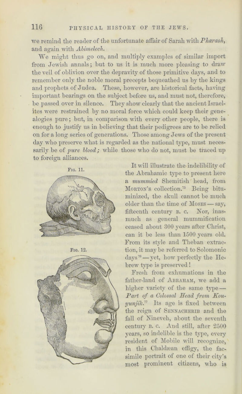 we remind tlic reader of tlie unfortunate affair of Sarali with Pharaoh, and again with Abimelech. We might thus go on, and multiply examples of similar import from Jewish annals; but to us it is much more pleasing to draw the veil of oblivion over the depravity of those primitive days, and to remember only the noble moral precepts bequeathed us by the kings and prophets of Judea. These, however, are historical facts, having important bearings on the subject before us, and must not, therefore, be passed over in silence. They show clearly that the ancient Israel- ites were restrained by no moral force which could keep their gene- alogies pure; but, in comparison with every other people, there is enough to justify us in believing that their pedigrees are to be relied on for a long series of generations. Those among Jews of the present day who preserve what is regarded as the national type, must neces- sarily be of pure blood ; while to foreign alliances. Fig. 11. those who do not, must be traced up It will illustrate the indelibility of the Abrahamic type to present here a mummied Shemitish head, from Morton’s collection.75 Being bitu- minized, the skull cannot be much older than the time of Moses — sav, fifteenth century b. c. Nor, inas- much as general mummification ceased about 800 vears after Christ, can it be less than 1500 years old. From its style and Theban extrac- tion, it may be referred to Solomonic days76 — yet, how perfectly the He- brew type is preserved! Fresh from exhumations in the father-land of Abraham, we add a higher variety of the same type — Part of a Colossal Head from Kou- yunjikP Its age is fixed between the reign of Sennacherib and the fall of Nineveh, about the seventh century b. c. And still, after 2500 years, so indelible is the type, every resident of Mobile will recognize, in this Chaldsean effigy, the fac- simile portrait of one of their city’s most prominent citizens, who is