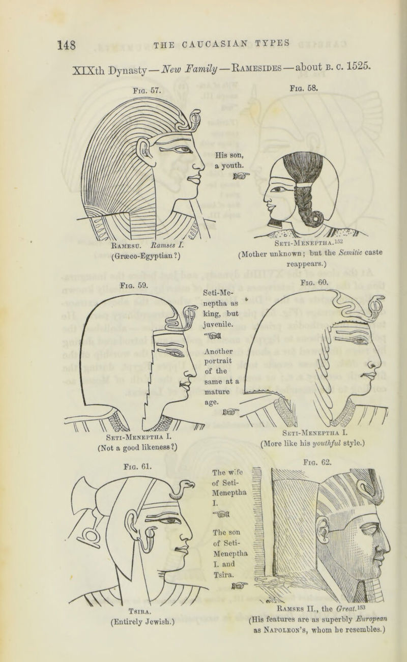 XlXtli Dynasty — New Family—Ramesides — about b. c. 1525. Fig. 57. Fig. ^8. (Grseco-Egjrptian ?) Seti-Meneptha.^2 (Mother unknown ; but the Semitic caste reappears.) Fig. 59. Fio. 60. Seti-Me- neptlm as king, but juvenile. “©a Another portrait of the same at a mature age. Seti-Meneptha I. (Not a good likeness ?) Seti-Meneptha I. (More like his youthful style.) Fig. 61. Tsira. (Entirely Jewish.) Fig. 62. The wife of Seti- Meneptha I. The son of Seti- Meneptha I. and Tsira. Ramses II., the Great.153 (His features are as superbly European as Napoleon’s, whom he resembles.)