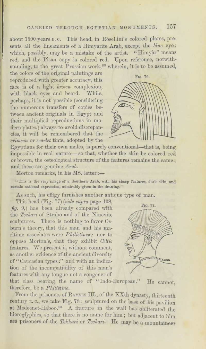 about 1500 years b. c. This bead, in Rosellini’s colored plates, pre- sents all the lineaments of a Ilimyarite Arab, except the blue eye; which, possibly, maybe a mistake of the artist. “Ilimyar” means < red, and the Pisan copy is colored red. Upon reference, notwith- standing, to the great Prussian work,163 wherein, it is to be assumed, the colors of the original paintings are reproduced with greater accuracy, this face is of a light brown complexion, with black eyes and beard. While, perhaps, it is not possible (considering the numerous transfers of copies be- tween ancient originals in Egypt and their multiplied reproductions in mo- dern plates,) always to avoid discrepan- cies, it will be remembered that the crimson or scarlet tints, adopted by the Egyptians for their own males, is purely conventional—that is, being impossible in real nature — so that, whether the skin be colored red or brown, the osteological structure of the features remains the same ; and these are genuine Arab. Morton remarks, in his MS. letter:— Fig. 76. Fig. 77. “ This is the very image of a Southern Arab, ■with his sharp features, dark skin, and certain national expression, admirably given in the drawing.'' As such, his effigy furnishes another antique type of man. This head (Fig. 7T) (vide supra page 108, jig. 9,) has been already compared with the Tochari of Strabo and of the Uinevite sculptures. There is nothing to favor Os- burn’s theory, that this man and his ma- ritime associates were Philistines; nor to oppose Morton’s, that they exhibit Celtic features. We present it, without comment, as another evidence of the ancient diversity of “Caucasian types and with an indica- tion of the incompatibility of this man’s features with any tongue not a congener of that class bearing the name of “Indo-European.” lie cannot, therefore, be a Philistine. From the prisoners of Ramses EH., of the XXth dynasty, thirteenth century b. c., we take Fig. 78: sculptured on the base of his pavilion at Medeenet-IIaboo.164 A fracture in the wall has obliterated the hieroglyphics, so that there is no name for him; but adjacent to him are prisoners of the Tokkari or Tochari. He may be a mountaineer