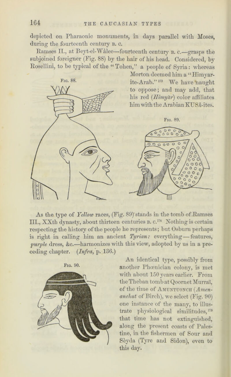 depicted on Pharaonic monuments, in days parallel with Moses, during the fourteenth century b. c. Ramses II., at Beyt-el-Walee—fourteenth century b. c.—grasps the subjoined foreigner (Fig. 88) by the hair of his head. Considered, by Rosellini, to he typical of the “ Tohen,” a people of Syria: whereas Morton deemed him a “Ilimyar- Fio. 88. ite-Arab.”173 We have naught to oppose; and may add, that his red (.llimyhr) color affiliates him with the Arabian KITS A-ites. Fig. 89. As the type of Yellow races, (Fig. 89) stands m the tomb of Ramses III., XXth dynasty, about thirteen centuries b. c.174 Nothing is certain respecting the history of the people he represents; but Osburn perhaps is right in calling him an ancient Tyrian: everything — features, purple dress, &c.—harmonizes with this view, adopted by us in a pre- ceding chapter. [Infra, p. 136.) Fig. 90. An identical type, possibly from another Phoenician colony, is met with about 150 years earlier. From the Theban tomb at Qoornet Murra'i, of the time of Amtjntuonch [Amen- anchut of Birch), we select (Fig. 90) one instance of the many, to illus- trate physiological similitudes,175 that time has not extinguished, along the present coasts of Pales- tine, in the fishermen of Sour and Seyda (Tyre and Sidon), even to this day.