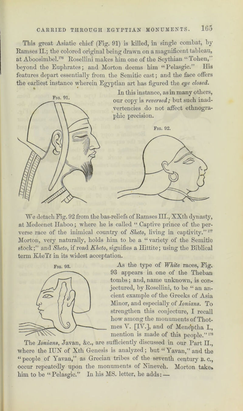 This great Asiatic chief (Fig. 91) is killed, in single combat, by Ramses II.; the colored original being drawn on a magnificent tableau, at Aboosimbel.176 Rosellini makes him one of the Scythian “ Token,” beyond the Euphrates; and Morton deems him “Pelasgic.” Ilia features depart essentially from the Semitic cast; and the face offers the earliest instance wherein Egyptian art has figured the eye closed. ^ • In this instance, as in many others, our copy is reversed; but such inad- vertencies do not affect ethnogra- phic precision. Fig. 92. Fig. 91. Fig. 93. We detach Fig. 92 from the bas-reliefs of Ramses III., XXth dynasty, at Medeenet Ilaboo; where he is called “ Captive prince of the per- verse race of the inimical country of Sheto, living in captivity.”177 Morton, very naturally, holds him to be a “variety of the Semitic stock;” and Sheto, if read Klieto, signifies a Ilittite; using the Biblical term KAeTi in its widest acceptation. As the type of White races, Fig. 93 appears in one of the Theban tombs; and, name unknown, is con- jectured, by Rosellini, to be “ an an- cient example of the Greeks of Asia Minor, and especially of Ionians. To strengthen this conjecture, I recall how among the monuments of Thot- mes V. [TV.], and of Meneptha I., mention is made of this people.”173 The Ionians, Javan, &c., are sufficiently discussed in our Part II., where the IUX of Xth Genesis is analyzed; but “ Yavan,” and the “people of Yavan,” as Grecian tribes of the seventh century b. c., occur repeatedly upon the monuments of Xineveli. Morton takes him to be “Pelasgic.” In his MS. letter, he adds: —