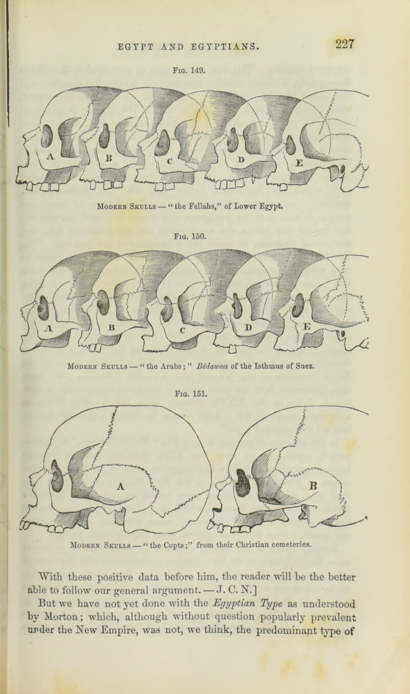 Fig. 149. Modern Skulls — “ the Fellahs,” of Lower Egypt. Fig. 150. Modern Skulls — “ the Arabs; ” Bedawees of the Isthmus of Suez. Fig. 151. Modern Skulls — “ the Copts from their Christian cemeteries. With these positive data before him, the reader will be the better able to follow our general argument. — J. C. N.] But we have not yet done with the Egyptian Type as understood by Morton; which, although without question popularly prevalent under the New Empire, was not, we think, the predominant type of