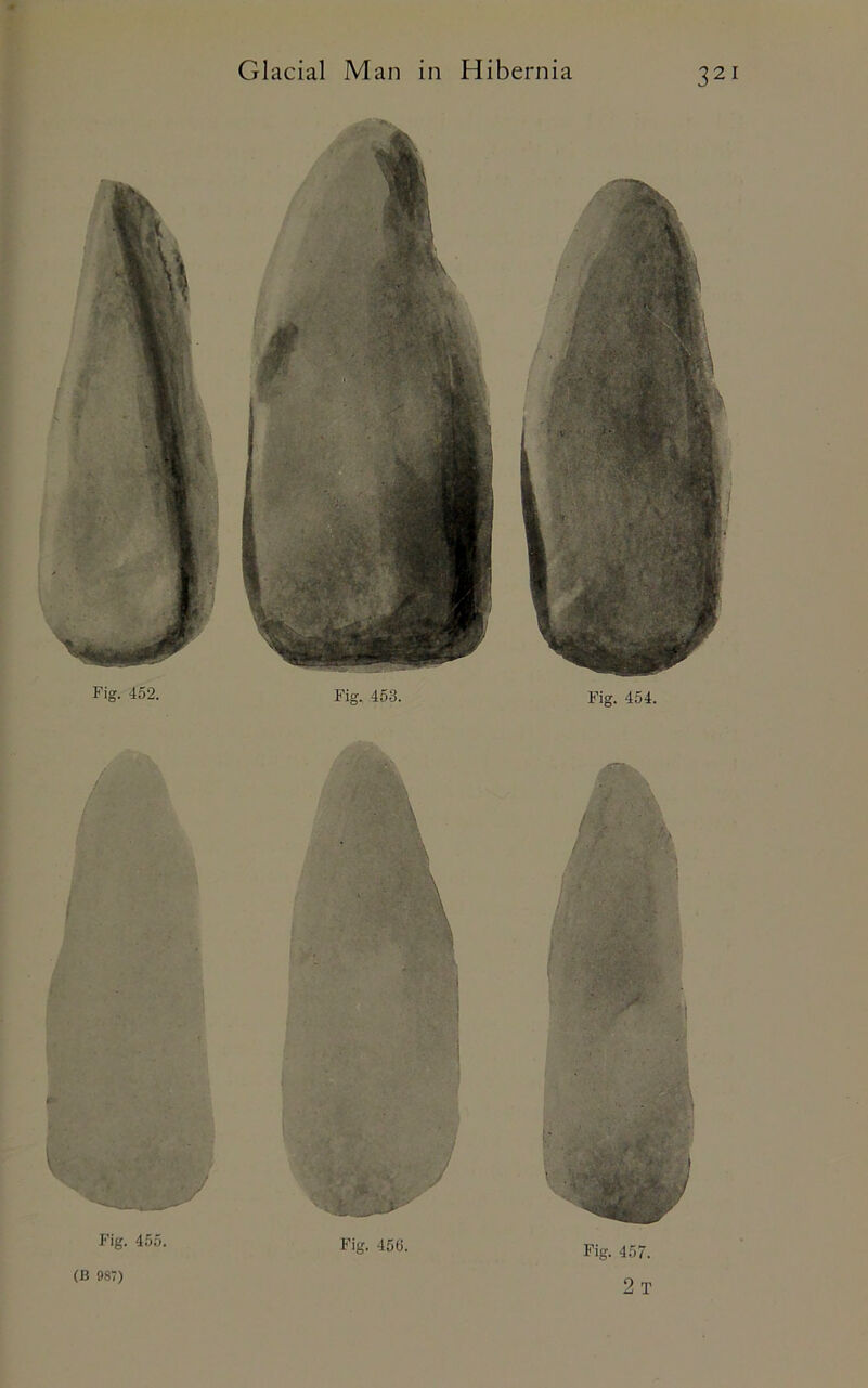 Fig. 455. Fig. 456. (B 987) Fig. 457. 2 T