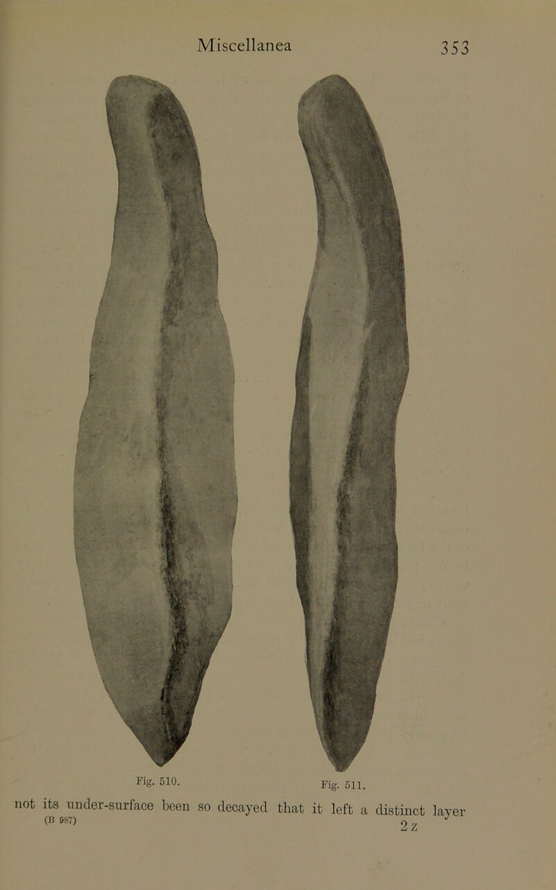 Fig. 510. Fig. 511. not its imder-surface been so decayed that it left a distinct layer (13 887) 2 ^