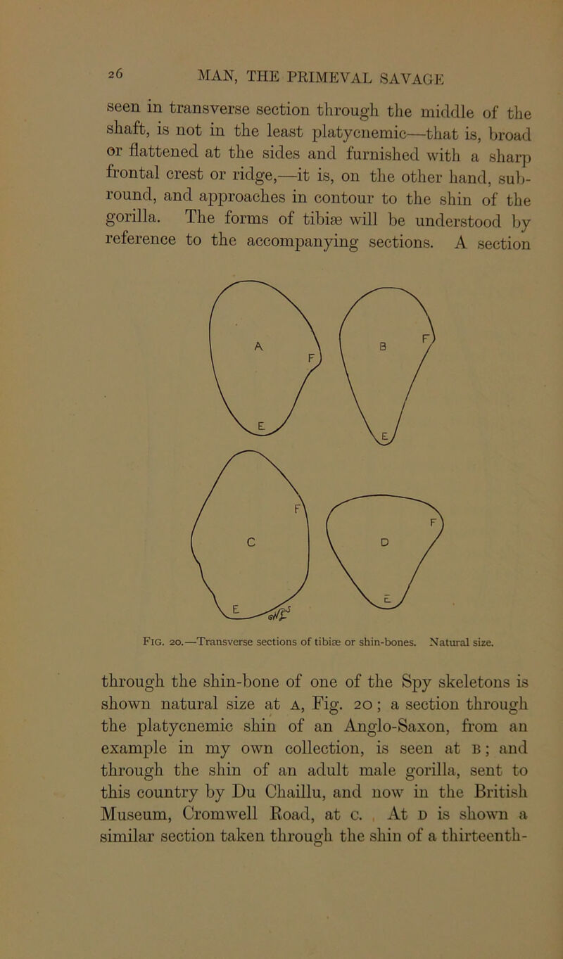 seen in transverse section through the middle of the shaft, is not in the least platycnemic—that is, broad or flattened at the sides and furnished with a sharp frontal crest or ridge—it is, on the other hand, sub- round, and approaches in contour to the shin of the gorilla. The forms of tibiae will be understood by reference to the accompanying sections. A section Fig. 20.—Transverse sections of tibiae or shin-bones. Natural size. through the shin-bone of one of the Spy skeletons is shown natural size at a, Fig. 20; a section through the platycnemic shin of an Anglo-Saxon, from an example in my own collection, is seen at b ; and through the shin of an adult male gorilla, sent to this country by Du Chaillu, and now in the British Museum, Cromwell Road, at c. At d is shown a similar section taken through the shin of a thirteenth-