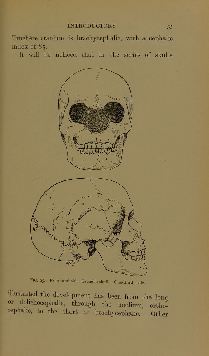 Truchere cranium is bracliycephalic, with a cephalic index of 85. It will he noticed that in the series of skulls illustrated the development has been from the Iona or dolichocephalic, through the medium, ortho° cephalic, to the short or bracliycephalic. Other