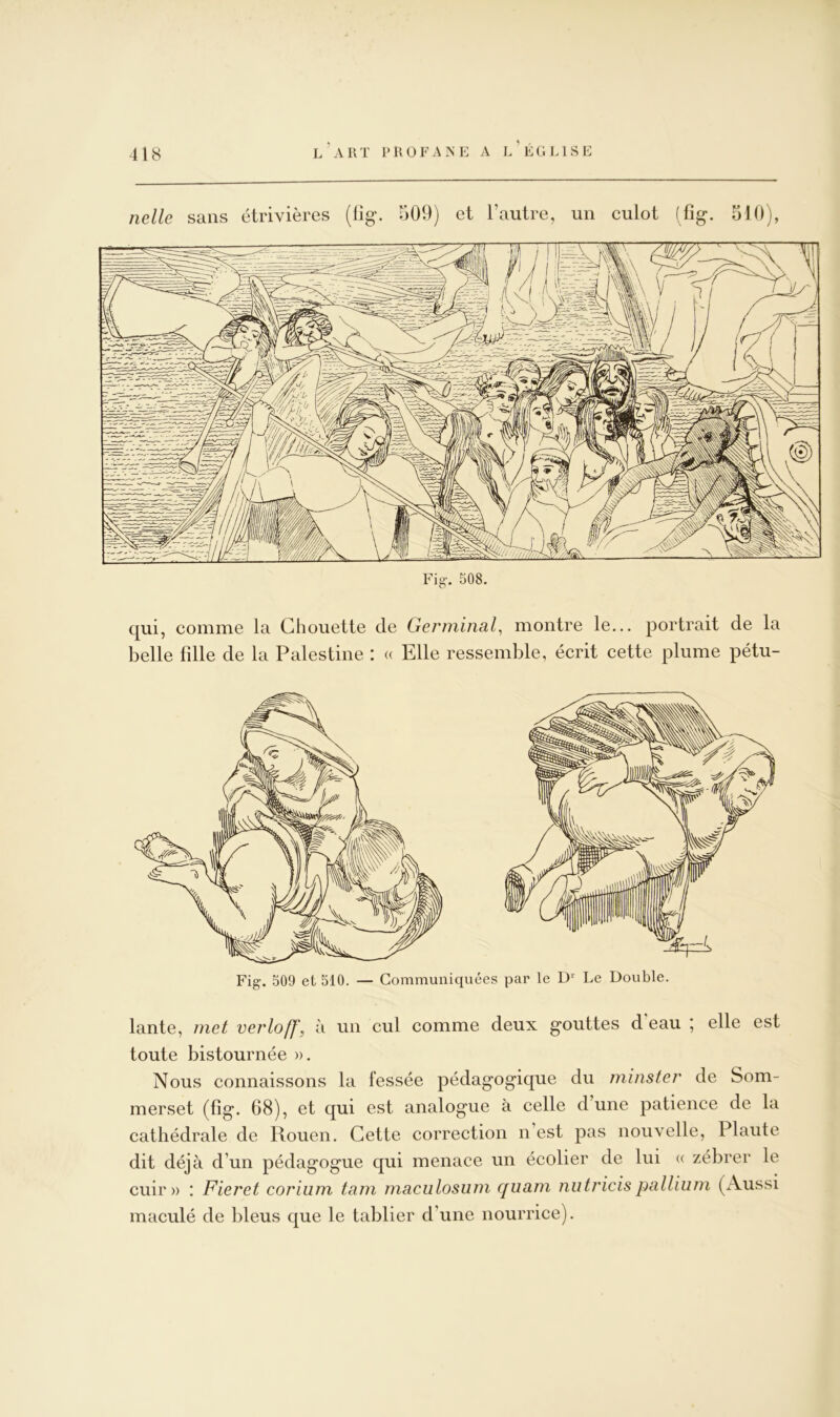 iielle sans étrivières (lig. 509) et l’autre, un culot (fig. 510), qui, comme la Chouette de Germinal, montre le... portrait de la belle fdle de la Palestine : « Elle ressemble, écrit cette plume pétu- Fig. 509 et 510. — Communiquées par le D‘‘ Le Double. lante, met verlojf, à un cul comme deux gouttes d eau * elle est toute bistournée ». Nous connaissons la fessée pédagogique du minster de Som- merset (fîg. 68), et qui est analogue à celle dune patience de la cathédrale de Rouen. Cette correction n est pas nouvelle, Plaute dit déjà d’un pédagogue qui menace un écolier de lui « zébrer le cuir» : Fieret coriiim tam maculosum quam nutricispallium (Aussi maculé de bleus que le tablier d’une nourrice).