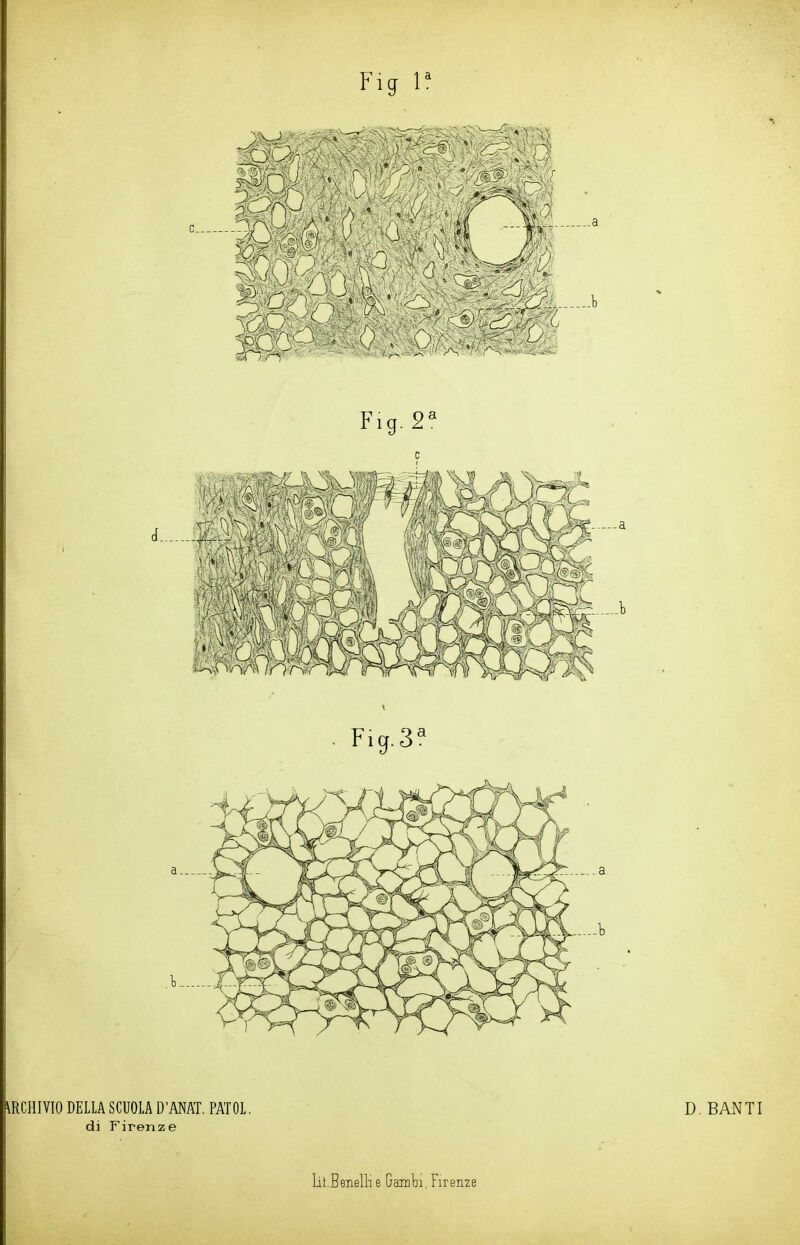 . Ficp 3a \RCHIVIO DELLA SCUOLA D’ANAT. PATOL. di Firenze D. BANTI Lit.Bsnelli e Gambi, Firenze