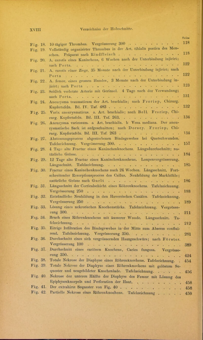 Fig. 18. Fig. 19. Fig. 20. Fig. 21. Fig. 22., Fig. 23. Fig. 24. Fig. 25. Fig. 20. Fig. 27. Fig. 28. Fig. 29. Fig. 30. Fig. 31. Fig. 32. Fig. 33. Fig. 34. Fig. 35. Fig. 36. Fig. 37. Fig. 38. Fig. 39. Fig. 40. Fig. 41. Fig. 42. 10 tägiger Thrombus. Vcrgrössernng 300 Vollständig orgnnisirter Thrombus in der Art. tibialis postica des Men- schen. Präparat nach Rindfleisch A. carotis eines Kaninchens, 0 Wochen nach der Unterbindung injicirt; nach Porta A. carotis einer Ziege, 35 Monate nach der Unterbindung injicirt; nach Porta A. femor. eines grossen Hundes, 3 Monate nach der Unterbindung in- jicirt; nach Porta Seitlich verletzte Arterie mit Gcrinscl. 4 Tage nach der Verwundung; nach Porta Aneurysma traumaticum der Art. brachialis; nach Froriep, Chirurg. Kupfcrtafeln. Bd. IV. Taf. 483 Varix aneurysmaticus. a. Art. brachialis; nach Bell. Froriep, Chi- rurg. Kupfertafeln. Bd. III. Taf. 263 Aneurysma varicosum. a Art. brachialis. b Vena mediana. Der aneu- rysmatische Sack ist aufgeschnitten; nach Dorsey. Froriep, Chi- rurg. Kupfertafeln. Bd. III. Taf. 263 Abstossungsprocess abgestorbenen Bindegewebes bei Quetschwunden. Tafelzeichnung. Vergrösserung 300 4 Tage alte Fractur eines Kaninchenknochens. Längsdurchschnitt; na- türliche Grösse. 12 Tage alte Fractur eines Kaninchenknochens. Loupenvergrösserung. Längsschnitt. Tafelzeichnung Fractur eines Kaninchenknochens nach 24 Wochen. Längsschnitt. Fort- schreitender Eesorptionsprocess des Callus. Neubildung der Markhöhle; natürliche Grösse nach Gurlt Längsschnitt der Corticalschicht eines Röhrenknochens. Tafelzeichnung. Vergrösserung 250 Entzündliche Neubildung in den Ilaversischen Canälen. Tafelzeichnung. Vergrösserung 250 Lösung eines nekrotischen Knochenstücks. Tafelzeichnung. Vergrösse- rung 300 Bruch eines Röhrenknochens mit äusserer Wunde. Längsschnitt. Ta- felzeichnnng Eitrige Infiltration des Bindegewebes in der Mitte zum Abscess confiui- rend. Tafelzcichnung. Vergrösserung 350 Durchschnitt eines sich vergrössernden Hautgeschwürs; nach Förster. Vergrösserung 100 Durchschnitt eines cariöscn Knochens, Caries fungosa. Vergrösse- rung 350 Totale Nekrose der Diaphyse eines Röhrenknochens. Tafelzeichnung. Totale Nekrose der Diaphyse eines Röhrenknochens mit gelöstem Se- quester und neugebildcter Knochenlade. Tafelzeichnung Nekrose der unteren Hälfte der Diaphyse des Femur mit Lösung des Epiphysenknorpels und Perforation der Haut. Der extraliirte Sequester von Fig. 40 Partielle Nekrose eines Röhrenknochens. Tafelzeichnuim Ö * * • Seite 118 118 122 122 123 131 132 134 134 157 184 185 186 188 189 211 212 281 389 424 454 456 458 458 459