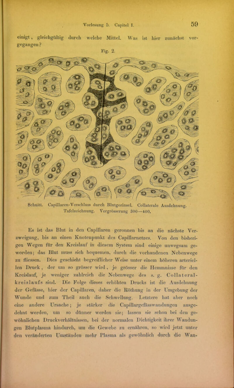 einigt, gleichgültig durch welche Mittel. Was ist hier zunächst vor- gegangen ? Fig. 2. Schnitt. Capillaren-Verschluss durch Blutgerinsel. Collaterale Ausdehnung. Tafelzeichnung. Vergrosserung 300—400. Es ist das Blut in den Capillaren geronnen bis an die nächste Ver- zweigung, bis an einen Knotenpunkt des Capillarnetzes. Von den bisheri- gen Wegen für den Kreislauf in diesem System sind einige unwegsam ge- worden; das Blut muss sich bequemen, durch die vorhandenen Nebenwege zu flicssen. Dies geschieht begreiflicher Weise unter einem höheren arteriel- len Druck , der um so grösser wird, je grösser die Hemmnisse für den Kreislauf, je weniger zahlreich die Nebenwege dos s. g. Collateral- kreislaufs sind. Die Folge dieses erhöhten Drucks ist die Ausdehnung der Gefässe, liier der Capillaren, daher die Röthung in der Umgebung der Wunde und zum Theil auch die Schwellung. Letztere hat aber noch eine andere Ursache; je stärker die CapillargefässWandungen ausge- dehnt werden, um so dünner werden sie; lassen sie schon bei den ge- wöhnlichen Druckverhältnissen, bei der normalen Dichtigkeit ihrer Wandun- gen Blutplasma hindurch, um die Gewebe zu ernähren, so wird jetzt unter den veränderten Umständen mehr Plasma als gewöhnlich durch die Wan*