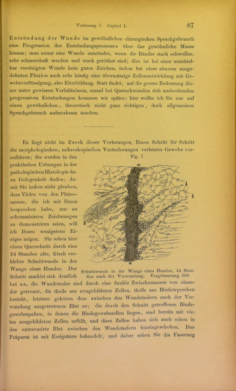 Entzündung der Wunde im gewöhnlichen chirurgischen Sprachgebrauch eine Progression des Entzündungsprocesses über das gewöhnliche Maass hinaus; man nennt eine Wunde entzündet, wenn die Ränder stark schwellen, sehr schmerzhaft werden und stark geröthet sind; dies ist bei einer unmittel- bar vereinigten Wunde kein gutes Zeichen, indem bei einer abnorm ausge- dehnten Fluxion auch sehr häufig eine übermässige Zellenentwicklung mit Ge- websverflüssigung, also Eiterbildung, Statt findet; auf die grosse Bedeutung die- ser unter gewissen Verhältnissen, zumal bei Quetschwunden sich ausbreitenden progressiven Entzündungen kommen wir später; hier wollte ich Sie nur auf einen gewöhnlichen , theoretisch nicht ganz richtigen , doch allgemeinen Sprachgebrauch aufmerksam machen. Es liegt nicht im Zweck dieser Vorlesungen, Ihnen Schritt für Schritt die morphologischen, mikroskopischen Veränderungen verletzter Gewebe vor- zuführen; Sie werden in den F’g* praktischen Uebungen in der pathologischen Histologie da- zu Gelegenheit finden; da- mit Sie indess nicht glauben, dass Vieles von den Phäno- menen, die ich mit Ihnen besprochen habe, nur an schematisirten Zeichnungen zu demonstriren seien, will ich Ihnen wenigstens Ei- niges zeigen. Sie sehen hier einen Querschnitt durch eine 24 Stunden alte, frisch ver- klebte Schnittwunde in der Wange eines Hundes. Der gchnittwunde in der Wange eines Hundes, 24 Stun- Schnitt markirt sich deutlich den nach der Verwundung. Vergrösserung 300. bei aa, die Wundränder sind durch eine dunkle Zwischenmasse von einan- der getrennt, die theils aus neugebildeten Zellen, theils aus Blutkörpeichen besteht, letztere gehören dem zwischen den Wundrändern nach der Ver- wundung ausgetretenen Blut an; die durch den Schnitt getroffenen Binde- gewebsspalten, in denen die Bindegewebszellen liegen, sind bereits mit vie- len neugebildeten Zellen erfüllt, und diese Zellen haben sich auch schon in das extravasirte Blut zwischen den Wundrändern hineingeschoben. Das Präparat ist mit Essigsäure behandelt, und daher sehen Sie die Maserung