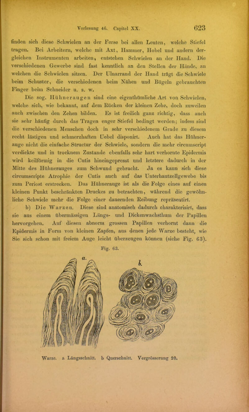 finden sich diese Schwielen an der Ferse hei allen Leuten, welche Stiefel tragen. Bei Arbeitern, welche mit Axt, Hammer, Hobel und andern der- gleichen Instrumenten arbeiten, entstehen Schwielen an der Hand. Die verschiedenen Gewerbe sind fast kenntlich an den Stellen der Hände, an welchen die Schwielen sitzen. Der Ulnarrand der Hand trägt die Schwiele beim Schuster, die verschiedenen beim Nähen und Bügeln gebrauchten Finger beim Schneider u. s. w. Die sog. Hühneraugen sind eine eigenthümliche Art von Schwielen, welche sich, wie bekannt, auf dem Rücken der kleinen Zehe, doch zuweilen auch zwischen den Zehen bilden. Es ist freilich ganz richtig, dass auch sie sehr häufig durch das Tragen enger Stiefel bedingt werden; indess sind die verschiedenen Menschen doch in sehr verschiedenem Grade zu diesem recht lästigen und schmerzhaften Uebel disponirt. Auch hat das Hühner- auge nicht die einfache Structur der Schwiele, sondern die mehr circumscript verdickte und in trocknem Zustande ebenfalls sehr hart verhornte Epidermis wird keilförmig in die Cutis hineingepresst und letztere dadurch in der Mitte des Hühnerauges zum Schwund gebracht. Ja es kann sich diese circumscripte Atrophie der Cutis auch auf das Unterhautzellgewebe bis zum Periost erstrecken. Das Hühnerauge ist als die Folge eines auf einen kleinen Punkt beschränkten Druckes zu betrachten, während die gewöhn- liche Schwiele mehr die Folge einer dauernden Reibung repräsentirt. b) Die Warzen. Diese sind anatomisch dadurch charakterisirt, dass sie aus einem übermässigen Längs- und Dickenwachsthum der Papillen hervorgehen. Auf diesen abnorm grossen Papillen verhornt dann die Epidermis in Form von kleinen Zapfen, aus denen jede Warze besteht, wie Sie sich schon mit freiem Auge leicht überzeugen können (siehe Fig. 63). Fig. 63. Warze, a Längsschnitt, b Querschnitt. Vergrösserung 20.