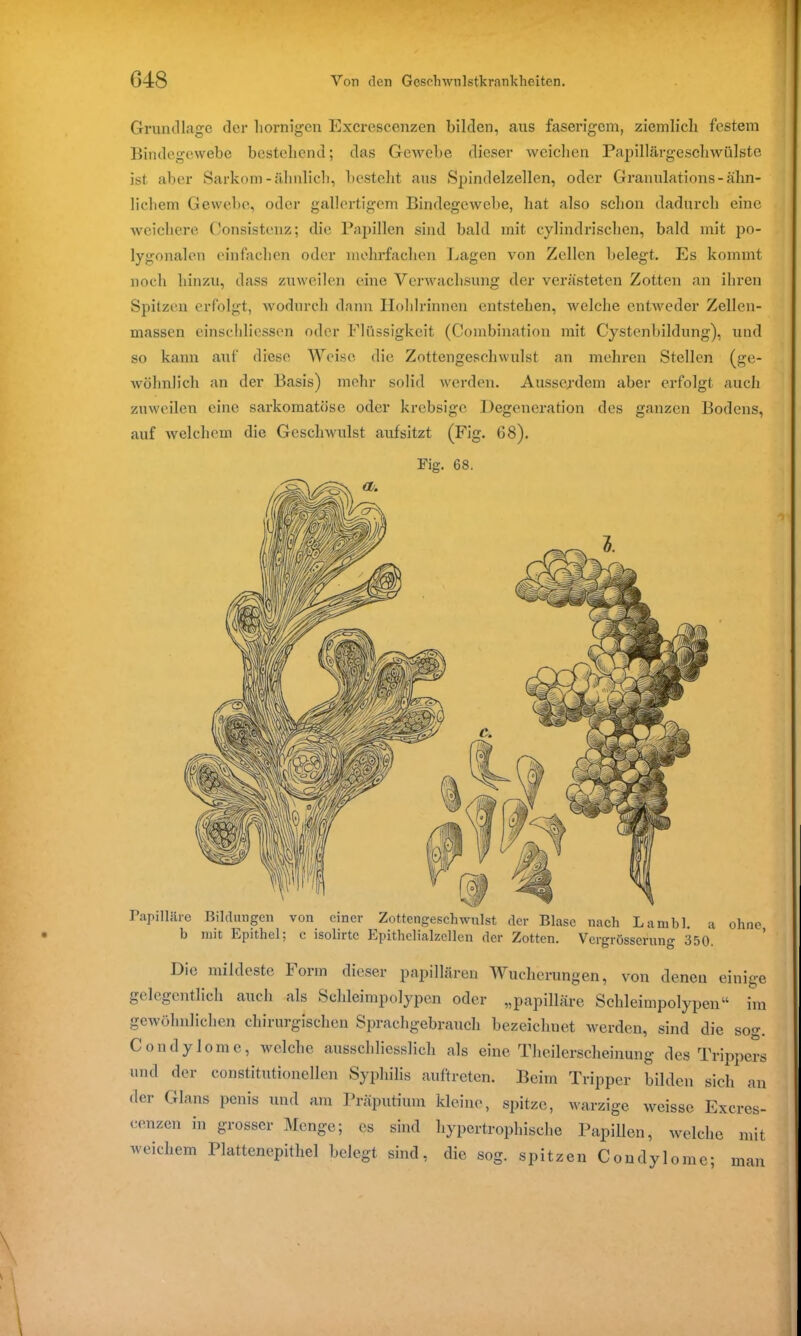 Grundlage der hornigen Excrescenzen bilden, aus faserigem, ziemlich festem Bindegewebe bestehend; das Gewebe dieser weichen Papillärgeschwülste ist aber Sarkom-ähnlich, besteht aus Spindelzellen, oder Granulations-ähn- lichem Gewebe, oder gallertigem Bindegewebe, hat also schon dadurch eine weichere Consistenz; die Papillen sind bald mit cylindrischen, bald mit po- lygonalen einfachen oder mehrfachen Lagen von Zellen belegt. Es kommt noch hinzu, dass zuweilen eine Verwachsung der verästeten Zotten an ihren Spitzen erfolgt, wodurch dann Hohlrinnen entstehen, welche entweder Zellen- massen einschliessen oder Flüssigkeit (Combination mit Cystenbildung), und so kann auf diese Weise die Zottengeschwulst an mehren Stellen (ge- wöhnlich an der Basis) mehr solid werden. Ausserdem aber erfolgt auch zuweilen eine sarkomatöse oder krebsige Degeneration des ganzen Bodens, auf welchem die Gesclnvulst aufsitzt (Fig. 68). Big. 68. Papilläre Bildungen von einer Zottengeschwulst der Blase nach Lambl. a ohne b mit Epithel; c isoliitc Epithelialzellen der Zotten. Vcrgrösscrung 350. Die mildeste hoi in dieser papillären AVuchcrungen, von denen einige gelegentlich auch als Schleimpolypen oder „papilläre Schleimpolypen“ im gewöhnlichen chirurgischen Sprachgebrauch bezeichnet werden, sind die sog. Condylome, welche ausschliesslich als eine Theilerscheinung des Trippers und der constitutioneilen Syphilis auftreten. Beim Tripper bilden sich an der Glans penis und am Präputium kleine, spitze, warzige weisse Excres- cenzen in grosser Menge; cs sind hypertrophische Papillen, welche mit weichem Plattenepithel belegt sind, die sog. spitzen Condylome; man