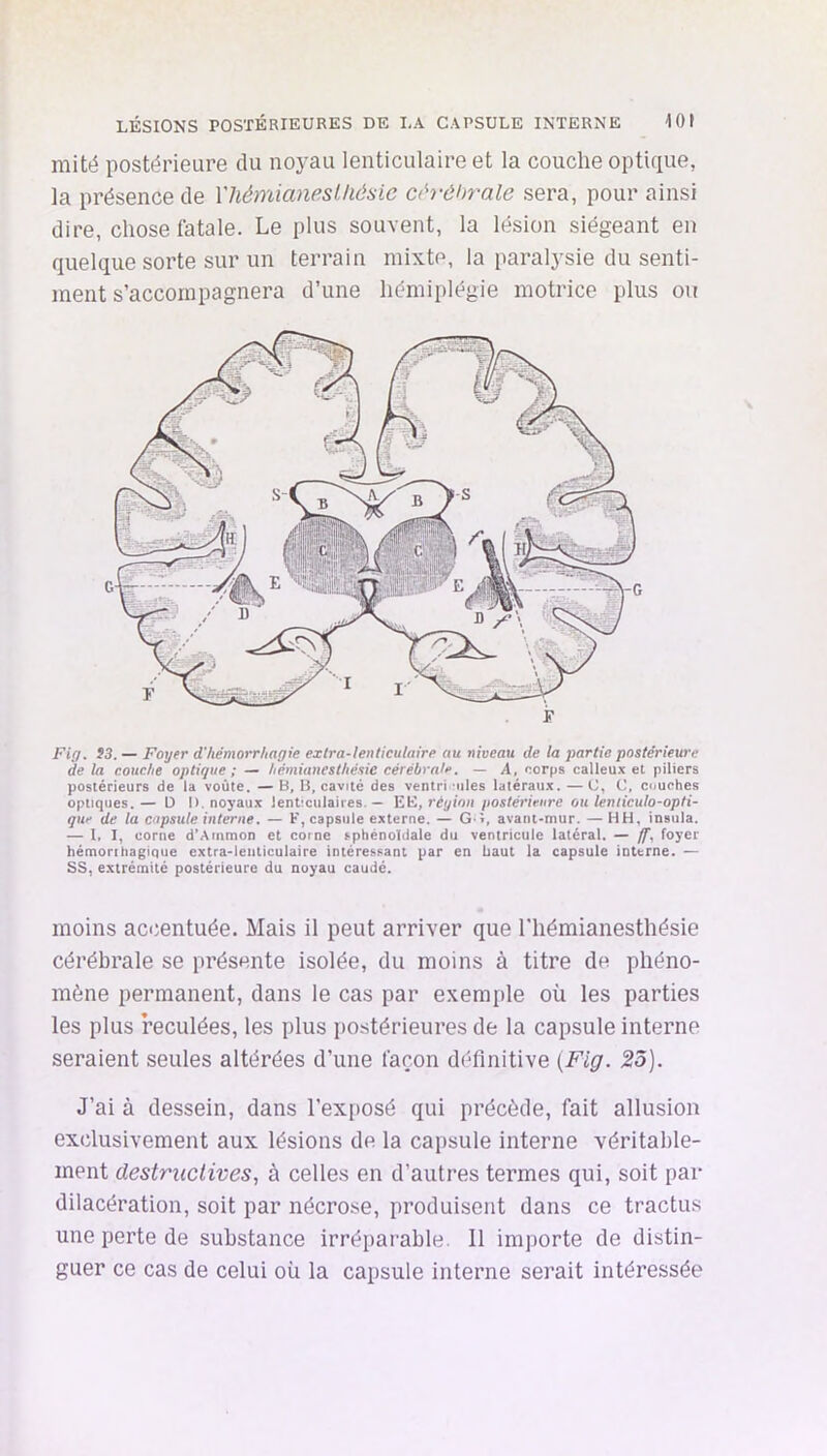 mité postérieure du noyau lenticulaire et la couche optique, la présence de Miémianeslhésie oh-ôhrale sera, pour ainsi dire, chose fatale. Le plus souvent, la lésion siégeant en quelque sorte sur un terrain mixte, la paralysie du senti- ment s’accompagnera d’une hémiplégie motrice plus ou Fig. S3. — Foyer d’hémorrhagie extra-lenticulaire au niveau de la partie postérieure de la couche optique ; — hémianesthésie cérébrale. — A, corps calleux et piliers postérieurs de la voûte. — B, B, cavité des ventri nies latéraux. — C, 0, cuuches optiques.— D I). noyaux lenticulaires. — région postérieure ou lenliculo-opti- que de la capsule interne. — F, capsule externe. — G-î, avant-mur. — HH, insula. — 1. I, corne d’Ainmon et coine sphénoïdale du ventricule latéral. — foyer hémorihagique extra-lenticulaire intéressant par en haut la capsule interne. — SS, extrémité postérieure du noyau caudé. moins accentuée. Mais il peut arriver que l'hémianesthésie cérébrale se présente isolée, du moins à titre de phéno- mène permanent, dans le cas par exemple où les parties les plus reculées, les plus postérieures de la capsule interne seraient seules altérées d’une façon définitive {Fig. 23). J’ai à dessein, dans l’exposé qui précède, fait allusion exclusivement aux lésions de la capsule interne véritable- ment destructives, à celles en d’autres termes qui, soit par dilacération, soit par nécrose, produisent dans ce tractus une perte de substance irrépai’ahle. 11 importe de distin- guer ce cas de celui où la capsule interne serait intéressée