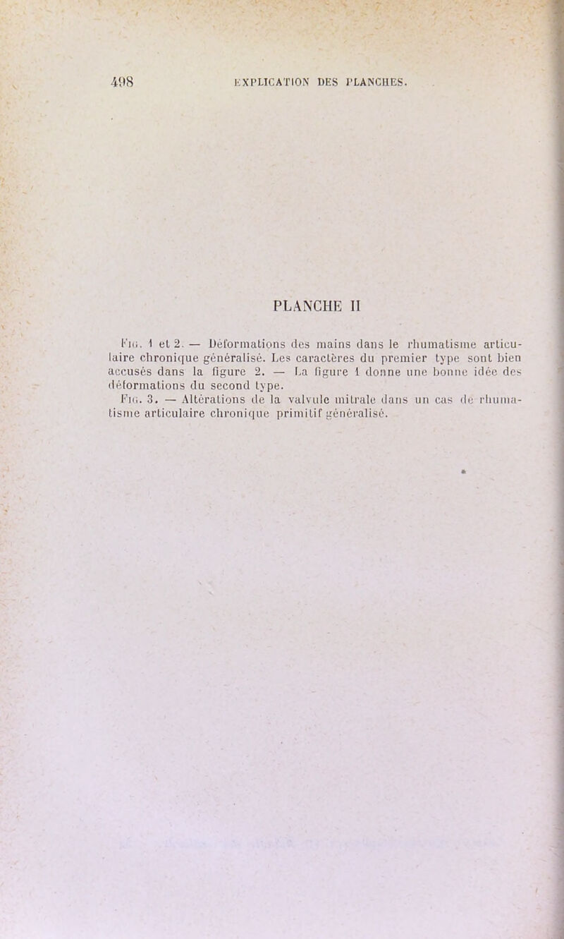 PLANCHE II Fie. 1 et 2. — Déformations des mains dans le rhumatisme articu- laire chronique généralisé. Les caractères du premier type sont bien accusés dans la figure 2. — La figure 1 donne une bonne idée des déformations du second type. Pin. 3. — Altérations de la valvule mitrale dans un cas de rhuma- tisme articulaire chronique primitif généralisé.