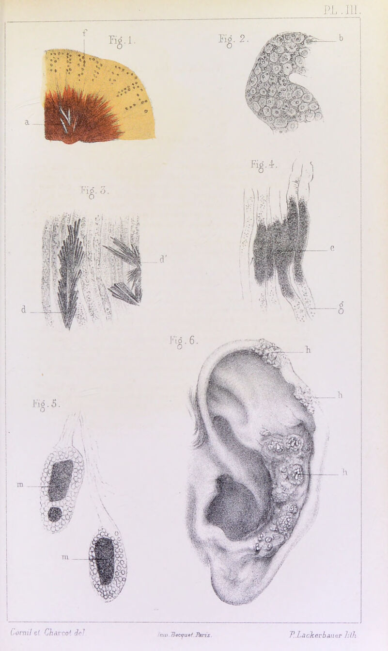 PI,. III Comil et Charroi fat mu rJocvuaf Paris. TLackerbaner hth