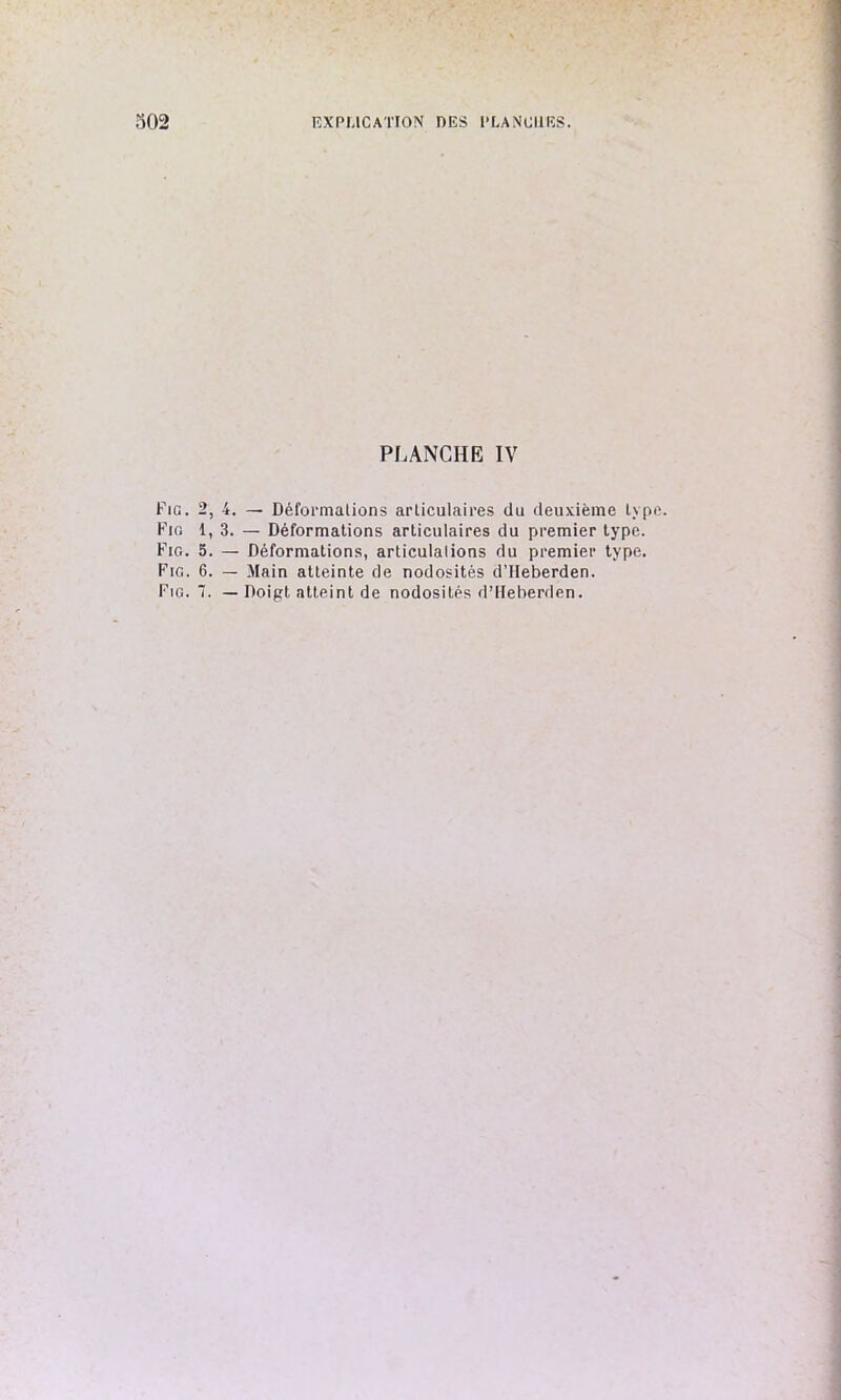 PLANCHE IV Fig. 2, 4. — Déformations articulaires du deuxième lyp Fig 1, 3. — Déformations articulaires du premier type. Fig. 5. — Déformations, articulalions du premier type. Fig. 6. — Main atteinte de nodosités d’Heberden. Fig. — Doigt atteint de nodosités d’Iteberden.