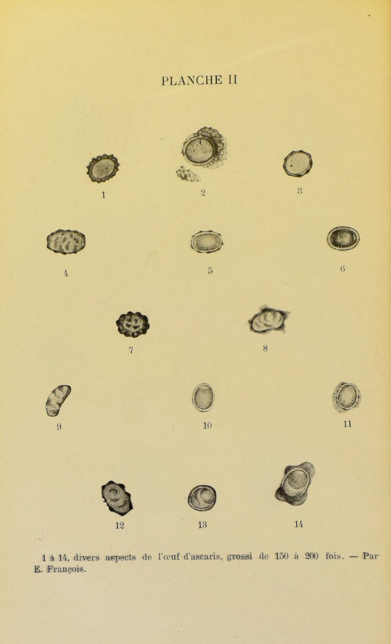l à 14, di-vers aspects de l’œuf d’ascaris, grossi de 150 à 200 fois. — Par E. (François.