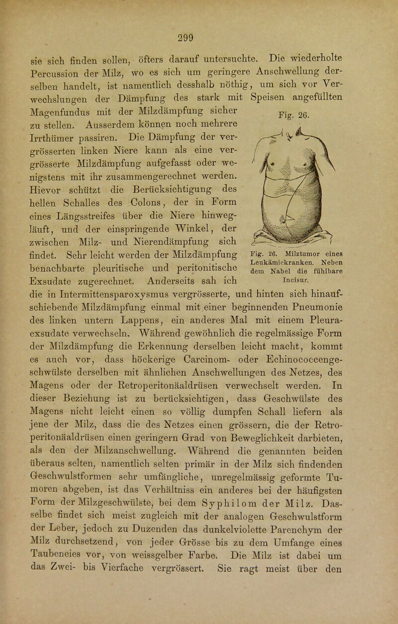 sie sich finden sollen, öfters darauf untersuchte. Die wiederholte Percussion der Milz, wo es sich um geringere Anschwellung der- selben handelt, ist namentlich desshalb nöthig, um sich vor Ver- wechslungen der Dämpfung des stark mit Speisen angefüllten Magenfundus mit der Milzdämpfung sicher zu stellen. Ausserdem können noch mehrere Irrthümer passiren. Die Dämpfung der ver- grösserten linken Niere kann als eine ver- grösserte Milzdämpfung aufgefasst oder we- nigstens mit ihr zusammengerechnet werden. Hievor schützt die Berücksichtigung des hellen Schalles des Colons, der in Form eines Längsstreifes über die Niere hinweg- läuft , und der einspringende Winkel, der zwischen Milz- und Nierendämpfung sich findet. Sehr leicht werden der Milzdämpfung benachbarte pleuritische und peritonitische Exsudate zugerechnet. Andei’seits sah ich die in Intermittensparoxysmus vergrösserte, und hinten sich hinauf- schiebende Milzdämpfung einmal mit einer beginnenden Pneumonie des linken untern Lappens, ein anderes Mal mit einem Pleura- exsudate verwechseln. Während gewöhnlich die regelmässige Form der Milzdämpfung die Erkennung derselben leicht macht, kommt es auch vor, dass höckerige Carcinom- oder Echinococcenge- schwiilste derselben mit ähnlichen Anschwellungen des Netzes, des Magens oder der Retroperitonäaldrüsen verwechselt werden. In dieser Beziehung ist zu berücksichtigen, dass Geschwülste des Magens nicht leicht einen so völlig dumpfen Schall liefern als jene der Milz, dass die des Netzes einen grossem, die der Retro- peritonäaldrüsen einen geringem Grad von Beweglichkeit darbieten, als den der Milzanschwellung. Während die genannten beiden überaus selten, namentlich selten primär in der Milz sich findenden Geschwulstformen sehr umfängliche, unregelmässig geformte Tu- moren abgeben, ist das Verhältniss ein anderes bei der häufigsten Form der Milzgeschwülste, bei dem Syphilom der Milz. Das- selbe findet sich meist zugleich mit der analogen Geschwulstform der Leber, jedoch zu Duzenden das dunkelviolette Parenchym der Milz durchsetzend, von jeder Grösse bis zu dem Umfange eines Taubeneies vor, von weissgelber Farbe. Die Milz ist dabei um das Zwei- bis Vierfache vergrössert. Sie ragt meist über den Fig. 26. Fig. 26. Milztumor eines Leukämiekranken. Neben dem Nabel die fühlbare Ineisur.