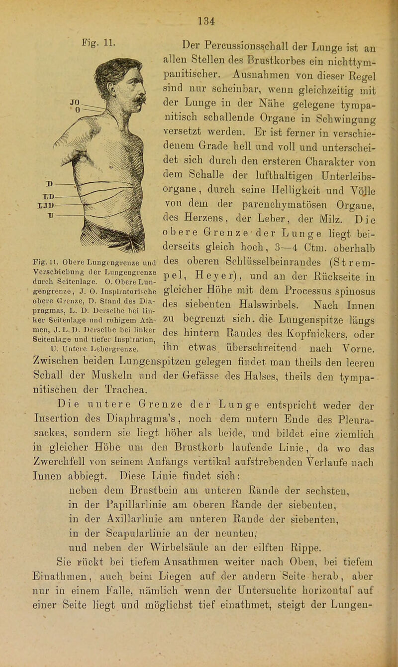 1 Der Percussiousschall der Luuge ist an allen Stellen des Brustkorbes ein niclittym- panitisclier. Ausnahmen von dieser Regel sind nur scheinbar, wenn gleichzeitig mit der Luuge in der Nähe gelegene tympa- nitisch schallende Organe in Schwingung versetzt werden. Er ist ferner in verschie- denem Grade hell und voll und unterschei- det sich durch den ersteren Charakter von dem Schalle der lufthaltigen ünterleibs- organe, durch seine Helligkeit und Vöjle von dem der parenchymatösen Organe, des Herzens, der Leber, der Milz. Die obere Grenze-der Lunge liegt bei- derseits gleich hoch, 3—4 Ctm. oberhalb Fig-. II. Obere Lungcngreiize und cRs oberen SchlÜSSelbeini'audeS (Strem- Verschiebung der Lungeng.^nze ] Heyer), und au der Rückseite in durch Seltenlage. O. Obere Lun- . •’ ' _ gengrenze, j. o. inspiraforhche gleicher Höhe mit dem Proccssus spiuosus obere Orenze D Stand des Dia- jes siebenten Halswirbels. Nach Innen pragmas, L. D. Derselbe bei lin- ker Seitenlage und ruhigem Atli- ZU begrenzt sich, die Lungenspitze längs men, J.L.D. Derselbe beUinker ,jes hiuteru Randes des Kopfuickers, oder Seltenlage und tiefer Inspiration, ^ ^ i U. Untere Uebergrenze. ihn etwas überschreitend nach Vorne. Zwischen beiden Lungenspitzen gelegen findet man theils den leeren Schall der Muskeln und der Gefässo des Halses, theils den tympa- nitischen der Trachea. Die untere Grenze der Luuge entspricht weder der Insertion des Diaphragma’s, noch dem untern Ende des Pleura- sackes, sondern sie liegt höher als beide, und bildet eine ziemlich in gleicher Höhe um den Brustkorb laufende Linie, da wo das Zwerchfell von seinem Anfangs vertikal aufstrebenden Verlaufe nach Innen abbiegt. Diese Linie findet sieb: neben dem Brustbein am unteren Rande der sechsten, in der Papillarlinie am oberen Rande der siebenten, in der Axillarlinie am unteren Rande der siebenten, in der Scapularlinie au der neunten, und neben der Wirbelsäule an der eilfteu Rippe. Sie rückt bei tiefem Ansathmen weiter nach Oben, bei tiefem Eiuatbmen, auch beim Liegen auf der andern Seite herab, aber nur in einem P'alle, nämlich wenn der Untersuchte horizontal' auf einer Seite liegt und möglichst tief einatbmet, steigt der Lungeu-