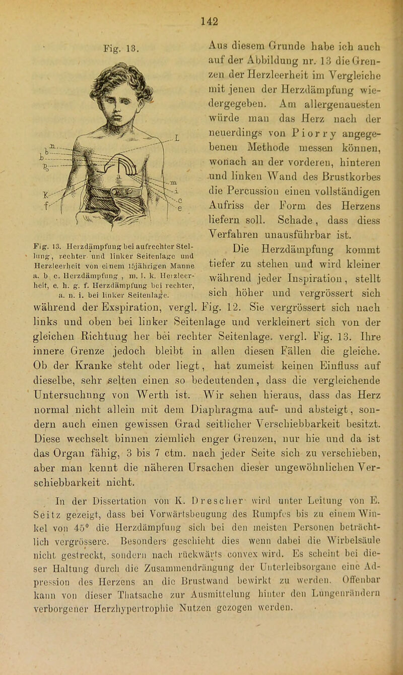 Aus diesem Grunde habe ich auch auf der Abbildung nr. 13 die Gren- zen der Herzleerheit im Vergleiche mit jenen der Herzdämpfung wie- dergegeben. Am allergenauesten würde man das Herz nach der neuerdings von Piorry angege- benen Methode messen können, wonach an der vorderen, hinteren und linken Wand des Brustkorbes die Percussion einen vollständigen Aufriss der Porm des Herzens liefern soll. Schade, dass diess Verfahren unausführbar ist. Die Herzdämpfuug kommt tiefer zu stehen und wird kleiner während jeder lu-bpiratiou, stellt sich höher und vergrössert sich während der Exspiration, vergl. Fig. 12. Sie vergrössert sich nach links und oben bei linker Seitenlage und verkleinert sich von der gleichen Richtung her bei rechter Seiteulage. vergl. Fig. 13. Ihre innere Grenze jedoch bleibt in allen diesen Fällen die gleiche. Ob der Kranke steht oder liegt, hat zumeist keinen Einflu.ss auf dieselbe, sehr selten einen so bedeutenden, dass die vergleichende Untersuchnng von Werth ist. Wir sehen hieraus, dass das Herz normal nicht allein mit dem Diaphragma auf- und absteigt, son- dern auch einen gewissen Grad seitlicher Verschiebbarkeit besitzt. Diese wechselt binnen ziemlich enger Grenzen, nur hie und da ist das Organ fähig, 3 bis 7 ctm. nach jeder Seite sich zu verschieben, aber man kennt die näheren Ursachen dieser ungewöhnlichen Ver- schiebbarkeit nicht. In der Dissertation von K. Drescher- wird unter Leitung von E. Seitz gezeigt, dass bei Vorwärtsbeugung des Rumpfes bis zu einem Win- kel von 45® die Herzdämpfung sich bei den meisten Personen beträcdit- lich vergrössere. Besonders geschielit dies wenn dabei die Wirbelsäule nicht gestreckt, sondern nach rückwärts convex wird. Es sclieint l>ei die- ser Haltung durch die Zusainmendrängung der Unterleibsorgane eine Ad- pression des Herzens an die Brustwand bewirkt zu werden. Oflenbar kann von dieser Tliatsaclie zur Ausmittelung hinter den Lungonrändern verborgener Hcrzh^’pertrophic Nutzen gezogen werden. Fig. 13. Fig:. 13. Hei zdämpfun bei aufrecliter Stel- lung:, rechter und linker Seitenlasc und Herzleerhcit von einem 15jähri{fen Manne a. b c. Herzdämpfung , m. I. k. lleizleev- heit, e. h. g. f. Herzdämplung bei rechter, a. n. i. bei linker Seitenlage.