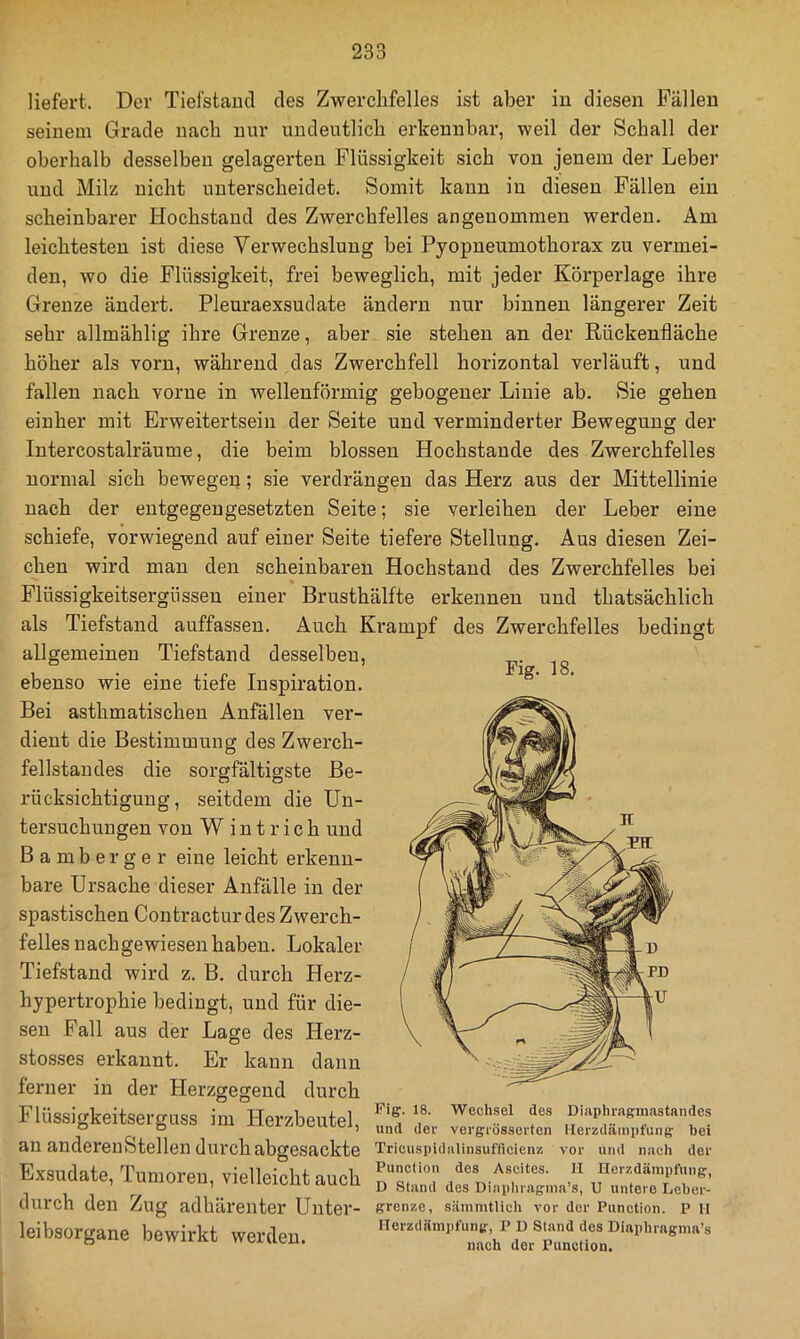 liefert. Der Tiefstand des Zwerchfelles ist aber iu diesen Fällen seinem Grade nach nur undeutlich erkennbar, weil der Schall der oberhalb desselben gelagerten Flüssigkeit sich von jenem der Leber und Milz nicht unterscheidet. Somit kann in diesen Fällen ein scheinbarer Hochstand des Zwerchfelles angenommen werden. Am leichtesten ist diese Verwechslung bei Pyopneumothorax zu vermei- den, wo die Flüssigkeit, frei beweglich, mit jeder Körperlage ihre Grenze ändert. Pleuraexsudate ändern nur binnen längerer Zeit sehr allmählig ihre Grenze, aber sie stehen an der Rückenfläche höher als vorn, während das Zwerchfell horizontal verläuft, und fallen nach vorne in wellenförmig gebogener Linie ab. Sie gehen einher mit Erweitertsein der Seite und verminderter Bewegung der Intercostalräume, die beim blossen Hochstande des Zwerchfelles normal sich bewegen; sie verdrängen das Herz aus der Mittellinie nach der entgegengesetzten Seite; sie verleihen der Leber eine schiefe, vorwiegend auf einer Seite tiefere Stellung. Aus diesen Zei- chen wird man den scheinbaren Hochstaud des Zwerchfelles bei Flüssigkeitsergüsseu einer Brusthälfte erkennen und thatsächlich als Tiefstand auffassen. Auch Krampf des Zwerchfelles bedingt allgemeinen Tiefstand desselben, . . • . . Fiff. J 8. ebenso wie eine tiefe Inspiration. Bei asthmatischen Anfällen ver- dient die Bestimmung des Zwerch- fellstandes die sorgfältigste Be- rücksichtigung, seitdem die Un- tersuchungen von Wintrich und B a m b e r g e r eine leicht erkenn- bare Ursache dieser Anfälle in der spastischen Contractur des Zwerch- felles nach gewiesen haben. Lokaler Tiefstand wird z. B. durch Herz- hypertrophie bedingt, und für die- sen Fall aus der Lage des Herz- stosses erkannt. Er kann dann ferner in der Herzgegend durch Flüssigkeitserguss im Herzbeutel, f Diaph^maatandes ® ® ’ und der vergrossorten llerzdampfung bei an anderenStellen durch abgesackte Tricuspidiiiinsufflcienz vor und nach der Exsudate, Tumoren, vielleichtauch Herzdämpibng, ^ jy Stand des Dinphraginn’s, U untero Leber- durch den Zug adhärenter Unter- grenze, sämmtlich vor der Function. P 11 leibsorgane bewirkt werden.