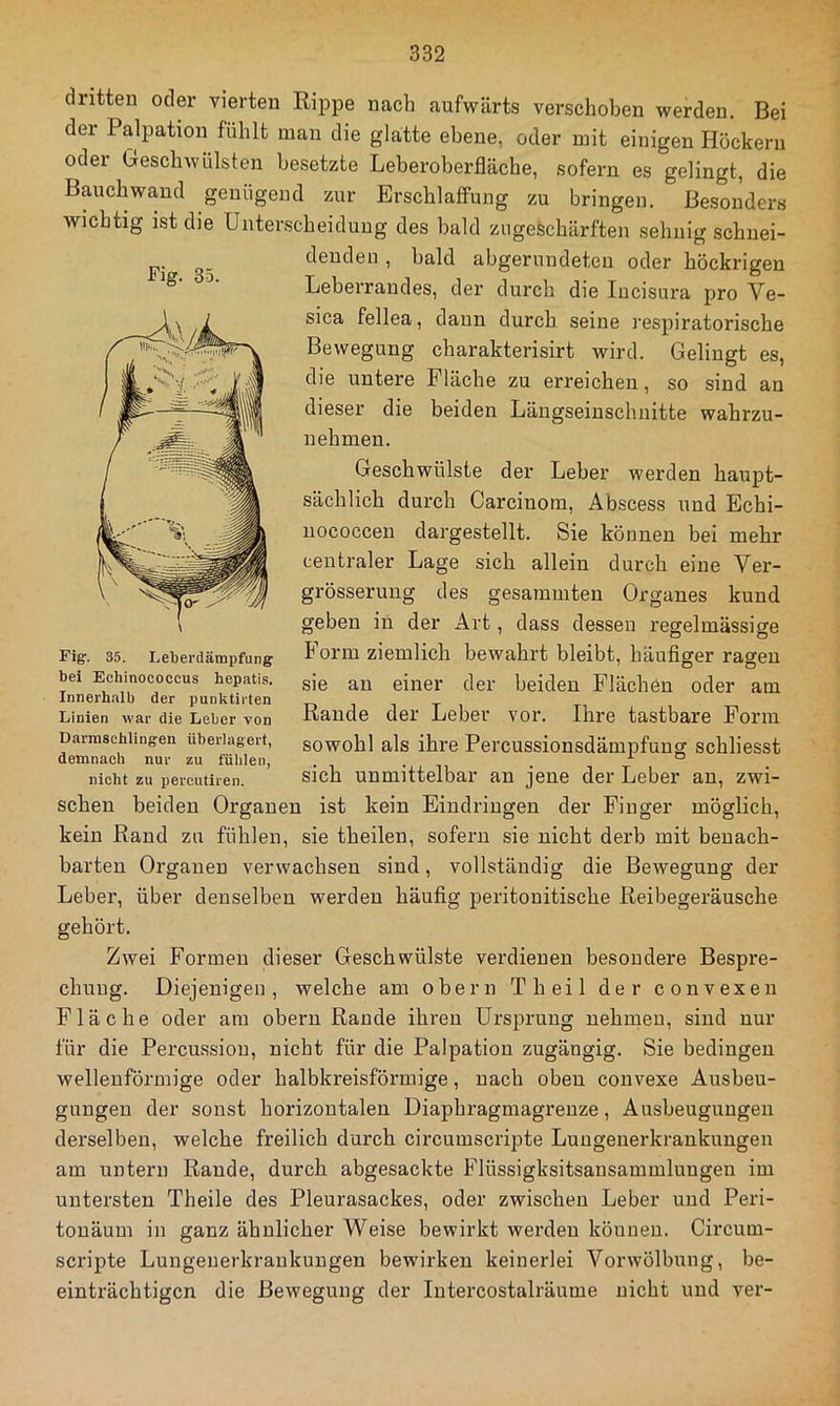 dritten oder vierten Rippe nach aufwärts verschoben werden. Bei der Palpation fühlt man die glatte ebene, oder mit einigen Höckern oder Geschwülsten besetzte Leberoberfläche, sofern es gelingt, die Bauchwand genügend zur Erschlaffung zu bringen. Besonders wichtig ist die Unterscheidung des bald ziigeschärften sehnig schnei- denden , bald abgerundeten oder höckrigen Leberrandes, der durch die lucisiira pro Ve- sica fellea, daun durch seine respiratorische Bewegung charakterisirt wird. Gelingt es, die untere Fläche zu erreichen, so sind an dieser die beiden Längseiuschnitte wahrzu- nehmen. Geschwülste der Leber werden haupt- sächlich durch Carcinom, Abscess und Echi- uococcen dargestellt. Sie können bei mehr centraler Lage sich allein durch eine Ver- grösserung des gesammten Organes kund geben in der Art, dass dessen regelmässige Form ziemlich bewahrt bleibt, häufiger ragen sie an einer der beiden Flächen oder am Rande der Leber vor. Ihre tastbare Form sowohl als ihre Percussionsdämpfuug schliesst sich unmittelbar au jene der Leber an, zwi- schen beiden Organen ist kein Eindringen der Finger möglich, kein Rand zu fühlen, sie theilen, sofern sie nicht derb mit benach- barten Organen verwachsen sind, vollständig die Bewegung der Leber, über denselben werden häufig peritonitische Reibegeräusche gehört. Zwei Formen dieser Geschwülste verdienen besondere Bespre- chung. Diejenigen, welche am obern Th eil der convexen Fläche oder am obern Rande ihren Ursprung nehmen, sind nur für die Percussion, nicht für die Palpation zugängig. Sie bedingen wellenförmige oder halbkreisförmige, nach oben convexe Ausbeu- gungeu der sonst horizontalen Diaphragmagreuze, Ausbeuguugeu derselben, welche freilich durch circumscripte Luugenerkrankungen am untern Rande, durch abgesackte Flüssigksitsansammluugeu im untersten Theile des Pleurasackes, oder zwischen Leber und Peri- touäum in ganz ähnlicher Weise bewirkt werden können. CRcum- scripte Lungenerkraukuugen bewirken keinerlei Vorwölbung, be- einträchtigen die Bewegung der lutercostalräume nicht und ver- Fig. 35. Fig. 35. Leberdämpfung bei Ecbinococcus hepatis. Innerhalb der punktiiten Linien war die Leber von Darnischlingen überlagert, demnach nur zu fülilen, nicht zu percutiren.