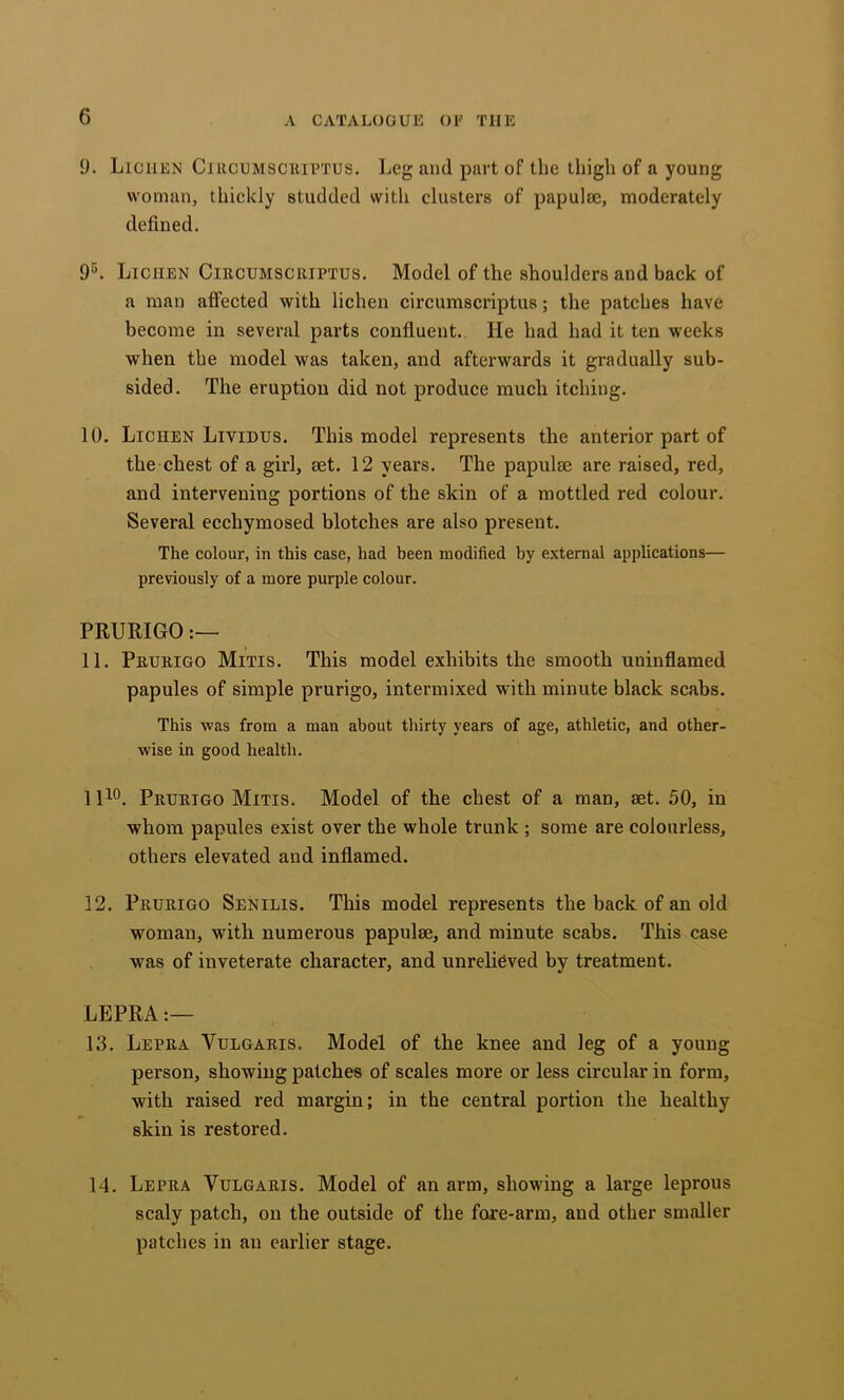 9. Lichen Ciucumscuittus. Leg and part of the thigh of a young woman, thickly studded with clusters of papulae, moderately defined. 9“^. Lichen Circumscriptus. Model of the shoulders and back of a man affected with lichen circumscriptus; the patches have become in several parts confluent. He had had it ten weeks when the model was taken, and afterwards it gradually sub- sided. The eruption did not produce much itching. 10. Lichen Ltvidus. This model represents the anterior part of the chest of a girl, aet. 12 years. The papulae are raised, red, and intervening portions of the skin of a mottled red colour. Several ecchymosed blotches are also present. The colour, in this case, had been modified by external applications— previously of a more purple colour. PRURIGO 11. Prurigo Mitis. This model exhibits the smooth uninflamed papules of simple prurigo, intermixed with minute black scabs. This was from a man about thirty years of age, athletic, and other- wise in good health. 1 po. Prurigo Mitis. Model of the chest of a man, aet. 50, in whom papules exist over the whole trunk ; some are colourless, others elevated and inflamed. 12. Prurigo Senilis. This model represents the back of an old woman, with numerous papulae, and minute scabs. This case was of inveterate character, and unrelieved by treatment. LEPRA:— 13. Lepra Vulgaris. Model of the knee and leg of a young person, showing patches of scales more or less circular in form, with raised red margin; in the central portion the healthy skin is restored. 14. Lepra Vulgaris. Model of an arm, showing a large leprous scaly patch, on the outside of the fore-arm, and other smaller patches in an earlier stage.