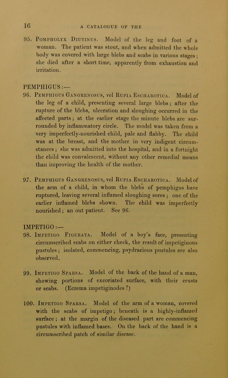 95. POMPIIOLYX Diutinus. Model of the leg and foot of a woman. The patient was stout, and when admitted the whole body was covered with large blebs and scabs in various stages; she died after a short time, apparently from exhaustion and irritation. PEMPHIGUS: — 96. Pemphigus Gangrenosus, vel Rupia Esciiarotica. Model of the leg of a child, presenting several large blebs; after the rupture of the blebs, ulceration and sloughing occurred in the affected parts; at the earlier stage the minute blebs are sur- rounded by inflammatory circle. The model was taken from a very imperfectly-nourished child, pale and flabby. The child was at the breast, and the mother in very indigent circum- stances ; she was admitted into the hospital, and in a fortnight the child was convalescent, without any other remedial means than improving the health of the mother. 97. Pemphigus Gangrenosus, vel Rupia Escharotica. Model of the arm of a child, in whom the blebs of pemphigus have ruptured, leaving several inflamed sloughing sores ; one of the earlier inflamed blebs shown. The child was imperfectly nourished; an out patient. See 96. IMPETIGO 98. Impetigo Figurata. Model of a boy’s face, presenting circumscribed scabs on either cheek, the result of impetiginous pustules ; isolated, commencing, psydracious pustules are also observed. 99. Impetigo Sparsa. Model of the back of the hand of a man, showing portions of excoriated surface, with their crusts or scabs. (Eczema impetiginodes ?) 100. Impetigo Sparsa. Model of the arm of a woman, covered with the scabs of impetigo; beneath is a highly-inflamed surface ; at the margin of the diseased part are commencing pustules with inflamed bases. On the back of the hand is a circumscribed patch of similar disease.