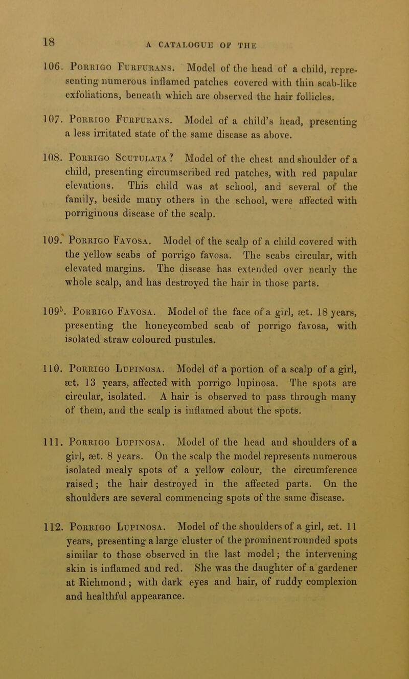 106. PORRIGO Furfurans. Model of the head of a child, repre- senting numerous inflamed patches covered with thin scab-like exfoliations, beneath which are observed the hair follicles. 107. PoRRiGO Furfurans. Model of a child’s head, presenting a less irritated state of the same disease as above. 108. PoRRiGO Scutulata? Model of the chest and shoulder of a child, presenting circumscribed red patches, with red papular elevations. This child was at school, and several of the family, beside many others in the school, were affected with porriginous disease of the scalp. 109. PoRRiGo Favosa. Model of the scalp of a child covered with the yellow scabs of porrigo favosa. The scabs circular, with elevated margins. The disease has extended over nearly the whole scalp, and has destroyed the hair in those parts. 109^. Porrigo Favosa. Model of the face of a girl, set. 18 years, presenting the honeycombed scab of porrigo favosa, with isolated straw coloured pustules. 110. Porrigo Lupinosa. Model of a portion of a scalp of a girl, set. 13 years, affected with porrigo lupinosa. The spots are circular, isolated. A hair is observed to pass through many of them, and the scalp is inflamed about the spots. 111. Porrigo Lupinosa. Model of the head and shoulders of a girl, set. 8 years. On the scalp the model represents numerous isolated mealy spots of a yellow colour, the circumference raised; the hair destroyed in the affected parts. On the shoulders are several commencing spots of the same disease. 112. Porrigo Lupinosa. Model of the shoulders of a girl, set. 11 years, presenting a large cluster of the prominent rounded spots similar to those observed in the last model; the intervening skin is inflamed and red. She was the daughter of a gardener at Richmond ; with dark eyes and hair, of ruddy complexion and healthful appearance.