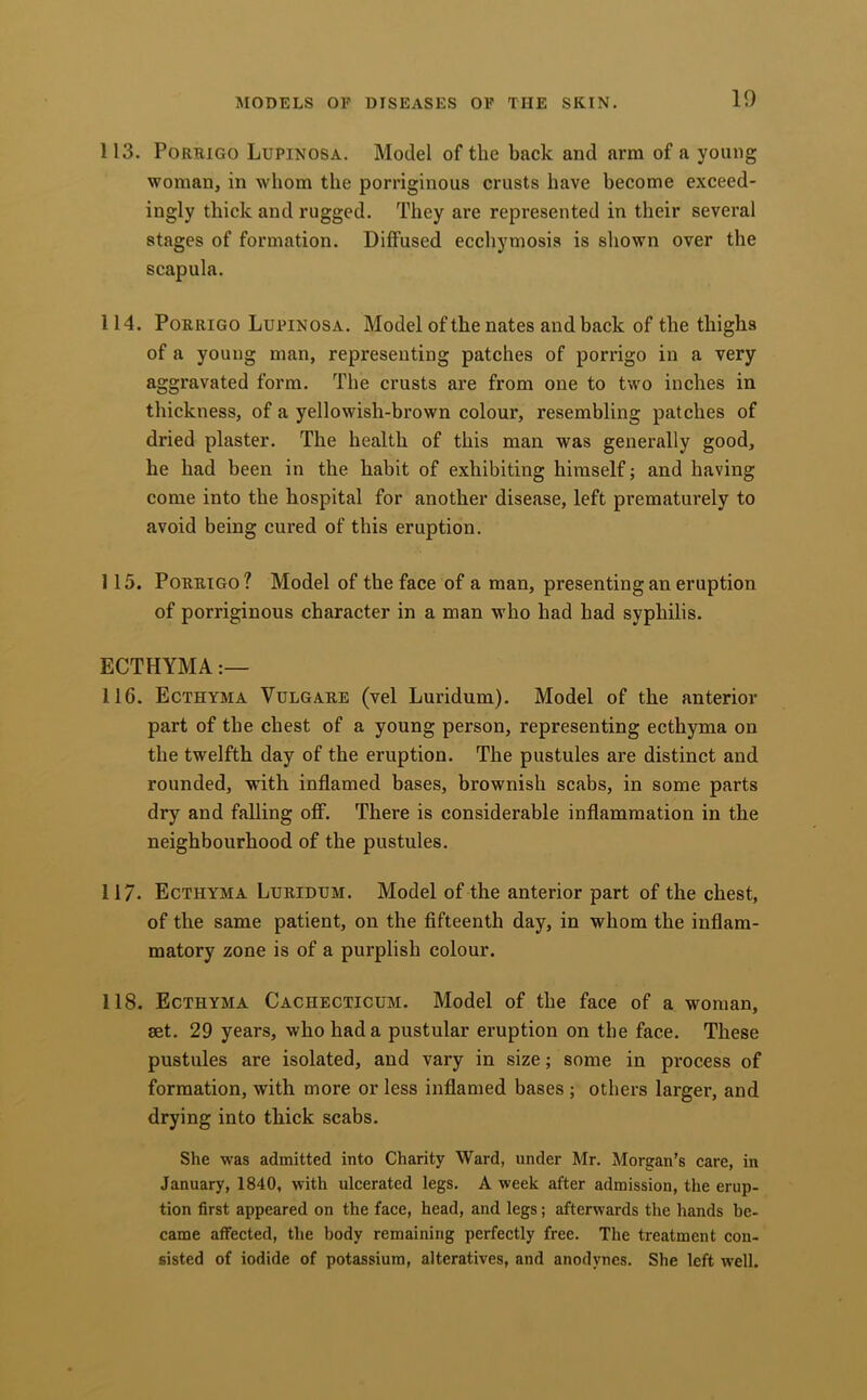 113. PoRRiGO Lupinosa. Model of the back and arm of a young woman, in whom the porriginous crusts have become exceed- ingly thick and rugged. They are represented in their several stages of formation. Diffused ecchymosis is shown over the scapula. 114. PoRRiGo Lupinosa. Model of the nates and back of the thighs of a young man, representing patches of porrigo in a very aggravated form. The crusts are from one to two inches in thickness, of a yellowish-brown colour, resembling patches of dried plaster. The health of this man was generally good, he had been in the habit of exhibiting himself; and having come into the hospital for another disease, left prematurely to avoid being cured of this eruption. 115. Porrigo? Model of the face of a man, presenting an eruption of porriginous character in a man who had had syphilis. ECTHYMA 116. Ecthyma Vulgare (vel Luridum). Model of the anterior part of the chest of a young person, representing ecthyma on the twelfth day of the eruption. The pustules are distinct and rounded, with inflamed bases, brownish scabs, in some parts dry and falling off. There is considerable inflammation in the neighbourhood of the pustules. 117. Ecthyma Luridum. Model of the anterior part of the chest, of the same patient, on the fifteenth day, in whom the inflam- matory zone is of a purplish colour. 118. Ecthyma Cachecticum. Model of the face of a woman, set. 29 years, who had a pustular eruption on the face. These pustules are isolated, and vary in size; some in process of formation, with more or less inflamed bases ; others larger, and drying into thick scabs. She was admitted into Charity Ward, under Mr. Morgan's care, in January, 1840, with ulcerated legs. A week after admission, the erup- tion first appeared on the face, head, and legs; afterwards the hands be- came affected, the body remaining perfectly free. The treatment con- sisted of iodide of potassium, alteratives, and anodynes. She left well.