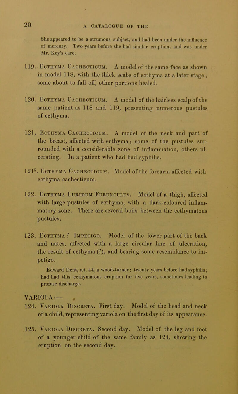 She appeared to be a strumous subject, and bad been under the influence of mercury. Two years before she had similar eruption, and was under Mr. Key’s care. 119. Ecthyma Cachecticum. A model of the same face as shown in model 118, with the thick scabs of ecthyma at a later stage ; some about to fall off, other portions healed. 120. Ecthyma Cachecticum. A model of the hairless scalp of the same patient as 118 and 119, presenting numerous pustules of ecthyma. 121. Ecthyma Cachecticum. A model of the neck and part of the breast, affected with ecthyma; some of the pustules sur- rounded with a considerable zone of inflammation, others ul- cerating. In a patient who had had syphilis. 121^. Ecthyma Cachecticum. Model of the forearm affected with ecthyma cachecticum. 122. Ecthyma Lueidum Fueunculus. Model of a thigh, affected with large pustules of ecthyma, with a dark-coloured inflam- matory zone. There are seveTal boils between the ecthymatous pustules. 123. Ecthyma? Impetigo. Model of the lower part of the back and nates, affected with a large circular line of ulceration, the result of ecthyma (?), and bearing some resemblance to im- petigo. Edward Dent, mt. 44, a wood-turner; twenty years before bad sypbibs; bad bad this ectbymatous eruption for five years, sometimes leading to profuse discharge. VARIOLA:— . 124. Vaeiola Disceeta. First day. Model of the head and neck of a child, representing variola on the first day of its appearance. 125. Vaeiola Disceeta. Second day. Model of the leg and foot of a younger child of the same family as 124, showing the eruption on the second day.