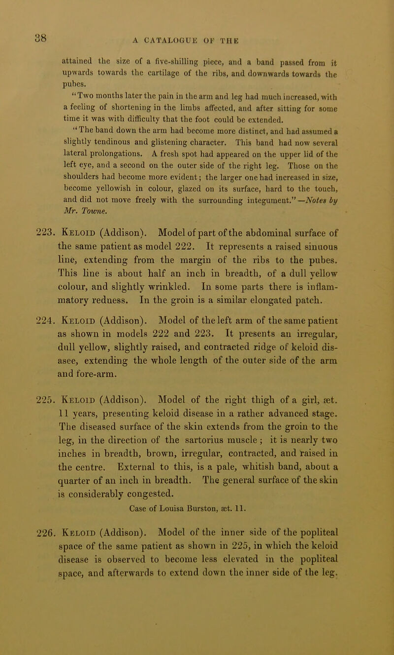 attained the size of a five-sliilling piece, and a band passed from it upwards towards the cartilage of the ribs, and downwards towards the pubes. “Two months later the pain in the arm and leg had much increased, with a feeling of shortening in the limbs affected, and after sitting for some time it was with diflSculty that the foot could be extended. “ The band down the arm had become more distinct, and had assumed a slightly tendinous and glistening character. This band had now several lateral prolongations. A fresh spot had appeared on the upper lid of the left eye, and a second on the outer side of the right leg. Those on the shoulders had become more evident; the larger one had increased in size, become yellowish in colour, glazed on its surface, hard to the touch, and did not move freely with the surrounding integument.”—Notes by Mr. Towne. 223. Keloid (Addison). Model of part of the abdominal surface of the same patient as model 222. It represents a raised sinuous line, extending from the margin of the ribs to the pubes. This line is about half an inch in breadth, of a dull vellow colour, and slightly wrinkled. In some parts there is inflam- matory redness. In the groin is a similar elongated patch. 224. Keloid (Addison). Model of the left arm of the same patient as shown in models 222 and 223. It presents an irregular, dull yellow, slightly raised, and contracted ridge of keloid dis- asee, extending the whole length of the outer side of the arm and fore-arm. 225. Keloid (Addison). Model of the right thigh of a girl, set. 11 years, presenting keloid disease in a rather advanced stage. The diseased surface of the skin extends from the groin to the leg, in the direction of the sartorius muscle ; it is nearly two inches in breadth, brown, irregular, contracted, and raised in the centre. External to this, is a pale, whitish band, about a quarter of an inch in breadth. The general surface of the skin is considerably congested. Case of Louisa Burston, act. 11. 226. Keloid (Addison). Model of the inner side of the popliteal space of the same patient as shown in 225, in which the keloid disease is observed to become less elevated in the popliteal space, and afterwards to extend down the inner side of the leg.