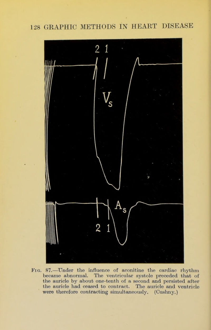 Fig. 87.—Under the influence of aconitine the cardiac rhythm became abnormal. The ventricular systole preceded that of the auricle by about one-tenth of a second and persisted after the auricle had ceased to contract. The auricle and ventricle were therefore contracting simultaneously. (Cuslmy,)