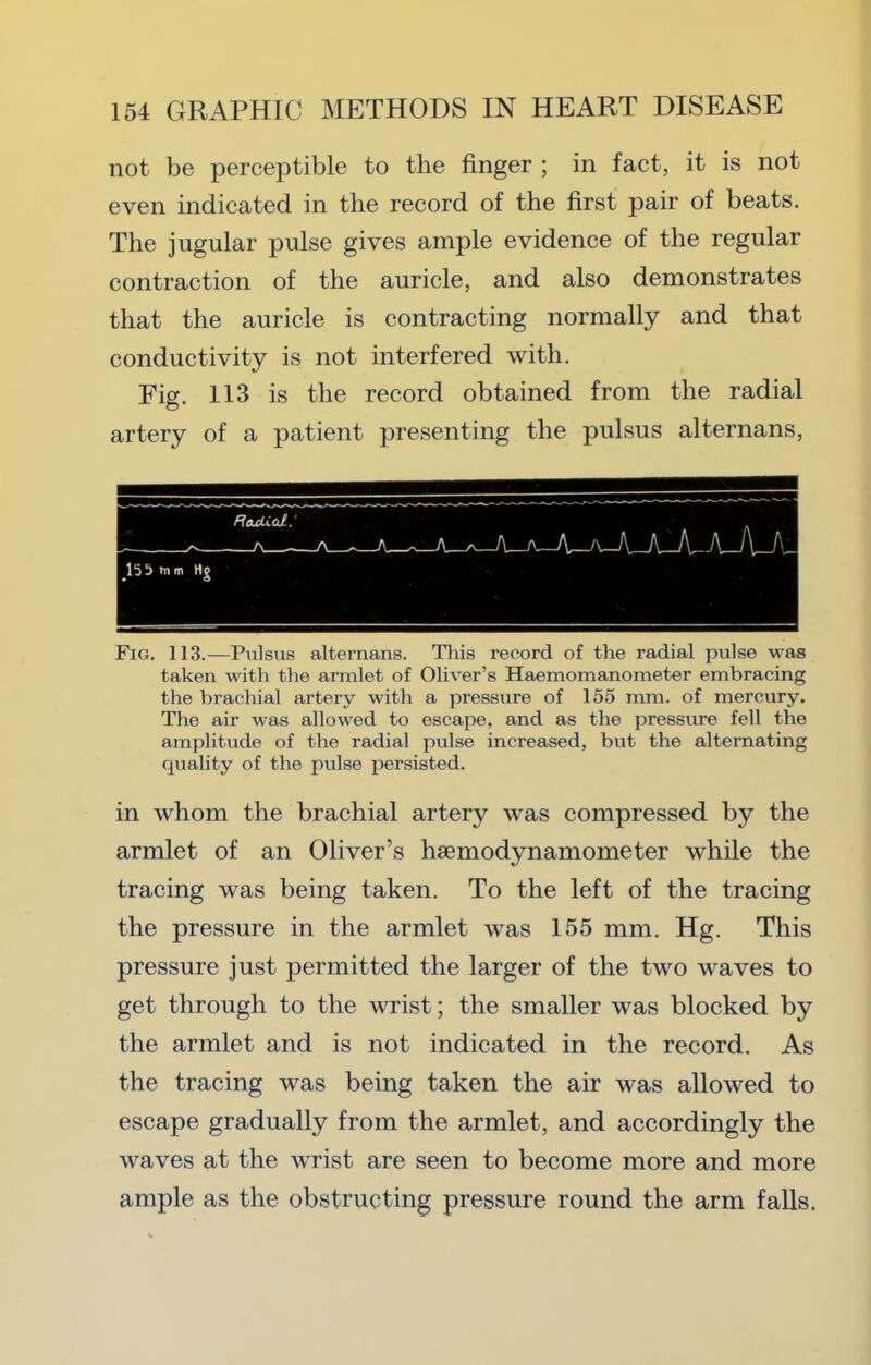 not be perceptible to the finger ; in fact, it is not even indicated in tlie record of the first pair of beats. The jugular pulse gives ample evidence of the regular contraction of the auricle, and also demonstrates that the auricle is contracting normally and that conductivity is not interfered with. Fig. 113 is the record obtained from the radial artery of a patient presenting the pulsus alternans. Fig. 113.—Pulsus alternans. Tliis record of the radial pulse was taken with the armlet of Oliver’s Haemomanometer embracing the brachial artery with a pressure of 155 mm. of mercury. The air was allowed to escape, and as the pressure fell the amplitude of the radial pulse increased, but the alternating quality of the pulse persisted. in whom the brachial artery was compressed by the armlet of an Oliver’s hsemodynamometer while the tracing was being taken. To the left of the tracing the pressure in the armlet was 155 mm. Hg. This pressure just permitted the larger of the two waves to get through to the wrist; the smaller was blocked by the armlet and is not indicated in the record. As the tracing was being taken the air was allowed to escape gradually from the armlet, and accordingly the waves at the wrist are seen to become more and more ample as the obstructing pressure round the arm falls.