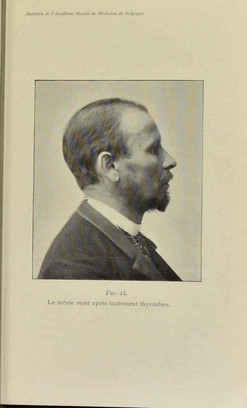 Fig. 23. Le même sujet après traitement thyroïdien.
