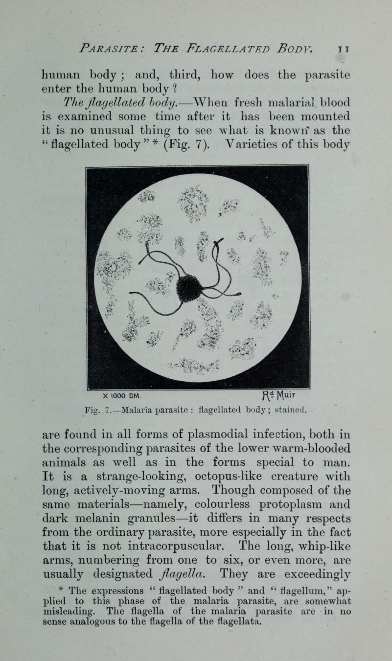 human body; and, third, how does the parasite enter the human body ? The flagellated body.—When fresh malarial blood is examined some time after it has been mounted it is no unusual thing to see what is known* as the “flagellated body” * (fig. 7). Varieties of this body x 1000 dm. |V\uir Fig. V.—Malaria parasite : flagellated body; stained. are found in all forms of plasmodial infection, both in the corresponding parasites of the lower warm-blooded animals as well as in the forms special to man. It is a strange-looking, octopus-like creature with long, actively-moving arms. Though composed of the same materials—namely, colourless protoplasm and dark melanin granules—it differs in many respects from the ordinary parasite, more especially in the fact that it is not intracorpuscular. The long, whip-like arms, numbering from one to six, or even more, are usually designated flagella. They are exceedingly * The expressions “ flagellated body ” and “ flagellum,” ap- plied to this phase of the malaria parasite, are somewhat misleading. The flagella of the malaria parasite are in no sense analogous to the flagella of the flagellata.