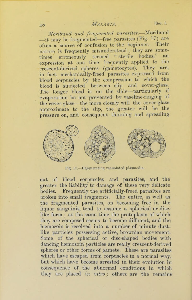 Moribund and frcKjmeAited parasites.—ISIoribnnd —it niay be fragmented—free parasites (Fig. 17)^ are often a source of confusion to the beginner, llieir nature is frequently misunderstood ; they are some- times erroneously termed “ sterile bodies,” an expression at one time frequently applied to the crescent-derived spheres (gametocytes). They are, in fact, mechanically-freed parasites expressed from blood corpuscles by the compression to which the blood is subjected between slip and cover-glass. The longer blood is on the slide—particularly if evaporation be not prevented by vaseline-ringing of the cover-glass—the more closely will the cover-glass approximate to the slip, the greater will be the pressure on, and consequent tliinning and spreading Fig. 17.—Degenerating vacuolated pla.sinodia. out of blood corpuscles and parasites, and the greater the liability to damage of these very delicate bodies. Frequently the artificially-freed parasites are broken into small fragments. The entire, as well as the fragmented parasites, on becoming free in the liquor sanguinis, tend to assume a spherical or disc- like form ; at the same time the protoplasm of which they are composed seems to become diffluent, and the luemozoin is I'esolved into a number of minute dust- like particles possessing active, brownian movement. Some of the spherical or disc-shaped bodies with dancing luemozoin particles are really crescent-derived spheres or other forms of gamete. These are parasites which have escaped from corpuscles in a normal way, but which have become arrested in their evolution in consequence of the abnormal conditions in which they are placed in vitro; others are the remains