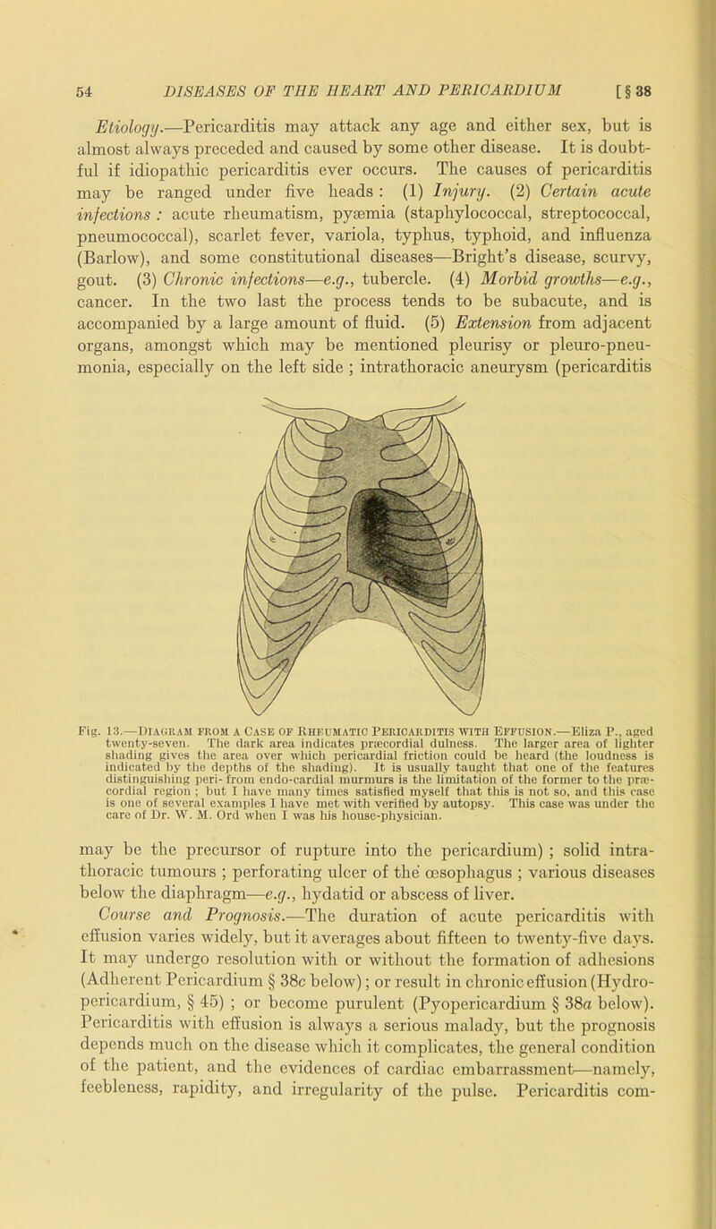 Etiology.—Pericarditis may attack any age and either sex, but is almost always preceded and caused by some other disease. It is doubt- ful if idiopathic pericarditis ever occurs. The causes of pericarditis may be ranged under five heads : (1) Injury. (2) Certain acute infections : acute rheumatism, pyaemia (staphylococcal, streptococcal, pneumococcal), scarlet fever, variola, typhus, typhoid, and influenza (Barlow), and some constitutional diseases—Bright’s disease, scurvy, gout. (3) Chronic infections—e.g., tubercle. (4) Morbid growths—e.g., cancer. In the two last the process tends to be subacute, and is accompanied by a large amount of fluid. (5) Extension from adjacent organs, amongst which may be mentioned pleurisy or pleuro-pneu- monia, especially on the left side ; intrathoracic aneurysm (pericarditis Fig. 13.—Diagram from a Case of lihfumatic Pericarditis with Effusion.—Eliza P., aged twenty-seven. The dark area indicates prsecordial dulness. The larger area of lighter shading gives the area over which pericardial friction could be heard (the loudness is indicated hy the depths of the shading). It is usually taught that one of the features distinguishing peri- from endo-cardial murmurs is the limitation of the former to the pra;- cordial region ; but I have many times satisfied myself that this is not so, and this case is one of several examples I have met with verified by autopsy. This case was under the care of Dr. W. M. Ord when I was his house-physician. may be the precursor of rupture into the pericardium) ; solid intra- thoracic tumours ; perforating ulcer of the oesophagus ; various diseases below the diaphragm—e.g., hydatid or abscess of liver. Course and Prognosis.—The duration of acute pericarditis with effusion varies widely, but it averages about fifteen to twenty-five days. It may undergo resolution with or without the formation of adhesions (Adherent Pericardium § 38c below); or result in chronic effusion (Hydro- pericardium, § 45) ; or become purulent (Pyopericardium § 38a below). Pericarditis with effusion is always a serious malady, but the prognosis depends much on the disease which it complicates, the general condition of the patient, and the evidences of cardiac embarrassment—namely, feebleness, rapidity, and irregularity of the pulse. Pericarditis com-