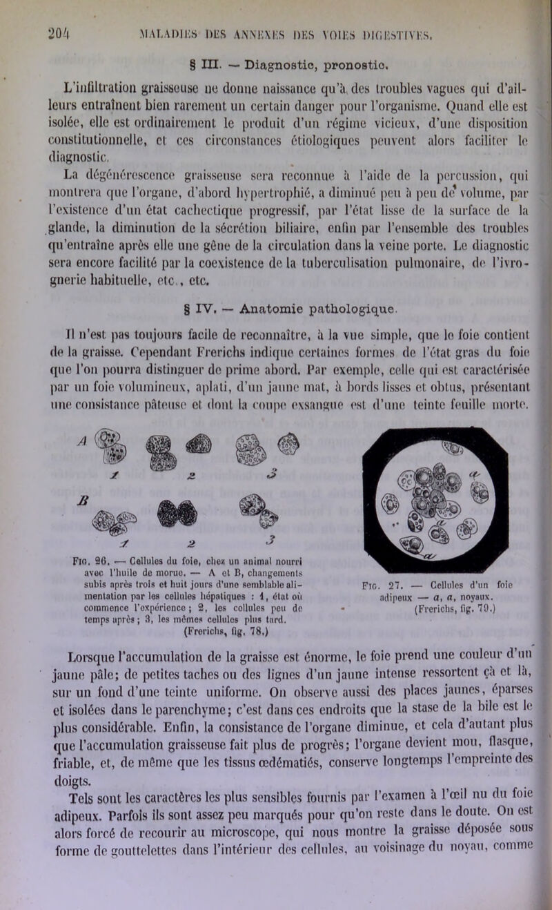 § III. ~ Diagnostic, pronostic. L’infiltration graisseuse ne donne naissance qu’à, des troubles vagues qui d’ail- leurs entraînent bien rarement un certain danger pour l’organisme. Quand elle est isolée, elle est ordinairement le produit d’un régime vicieux, d’une disposition constitutionnelle, et ces circonstances étiologiques peuvent alors faciliter le diagnostic. La dégénérescence graisseuse sera reconnue à l’aide de la percussion, qui montrera que l’organe, d’abord hypertrophié, a diminué peu à peu de volume, par l’existence d’un état cachectique progressif, par l’état lisse de la surface de la glande, la diminution de la sécrétion biliaire, enfin par l’ensemble des troubles qu’entraîne après elle une gène de la circulation dans la veine porte. Le diagnostic sera encore facilité parla coexistence delà tuberculisation pulmonaire, de l’ivro- gnerie habituelle, etc., etc. § IV. — Anatomie pathologique. Il n’est pas toujours facile de reconnaître, à la vue simple, que le foie contient de la graisse. Cependant Frerichs indique certaines formes de l’état gras du foie que l’on pourra distinguer de prime abord. Par exemple, celle qui est caractérisée par un foie volumineux, aplati, d’un jaune mat, à bords lisses et obtus, présentant une consistance pâteuse et dont la coupe exsangue est d’une teinte feuille morte. Fui. 96. — Cellules du foie, elle* un animal nourri avec l'huile de morue. — A et B, changements subis après trois et huit jours d'une semblable ali- mentation par les cellules hépatiques : \, état où commence i'oxperience j 2, les cellules pou do temps uprès ; 3, les mômes cellules plus tard. (Frerichs, fig. 78.) Fie. 27. — Cellules d’un foie adipeux — a, a, noyaux. (Frerichs, fig. 79.) Lorsque l’accumulation de la graisse est énorme, le foie prend une couleur d’un jaune pâle; de petites taches ou des lignes d’un jaune intense ressortent ça et la, sur un fond d’une teinte uniforme. On observe aussi des places jaunes, éparses et isolées dans le parenchyme; c’est dans ces endroits que la stase de la bile est le j plus considérable. Enfin, la consistance de l’organe diminue, et cela d’autant plus que l’accumulation graisseuse fait plus de progrès; l’organe devient mou, fiasque, friable, et, de même que les tissus œdématiés, conserve longtemps l’empreinte des doigts. Tels sont les caractères les plus sensibles fournis par l’examen à l’œil nu du foie adipeux. Parfois ils sont assez peu marqués pour qu’on reste dans le doute. On est alors forcé de recourir au microscope, qui nous montre la graisse déposée sous forme de gouttelettes dans l’intérieur des cellules, an voisinage du noyau, comme