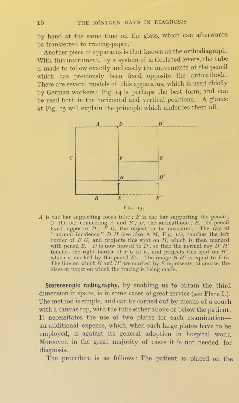 by hand at the same time on the glass, which can afterwards be transferred to tracing-paper. Another piece of apparatus is that known as the orthodiagraph. With this instrument, by a sj^stem of articulated levers, the tube is made to follow exactly and easily the movements of the pencil which has previously been fixed opposite the anticathode. There are several models of this apparatus, which is used chiefly by German workers; Fig. 14 is perhaps the best form, and can be used both in the horizontal and vertical positions. A glance at Fig. 15 will explain the principle which underlies them all. A D D F G H H' i * 1 I BE E' Fig. 15. A is the bar supporting focus tube ; B is the bar supporting the pencil ; C, the bar connecting A and B ; D, the anticathode ; E, the pencil fixed opposite D ; F G, the object to be measured. The ray of “ normal incidence,” D H (see also A M, Fig. 12), touches the left border of F G, and projects this spot on H, which is then marked with pencil E. D is now moved to D', so that the normal ray D' H' touches the right border of F G at G, and projects this spot on H'. which is marked by the pencil E'. The image FI H' is equal to F G. The line on which H and H' are marked by E represents, of course, the glass or paper on which the tracing is being made. Stereoscopic radiography, by enabling us to obtain the third dimension in space, is in some cases of great service (see Plate I.). The method is simple, and can be carried out by means of a couch with a canvas top, with the tube either above or below the patient. It necessitates the use of two plates for each examination— an additional expense, which, when such large plates have to be employed, is against its general adoption in hospital work. Moreover, in the great majority of cases it is not needed for diagnosis. The procedure is as follows: The patient is placed on the