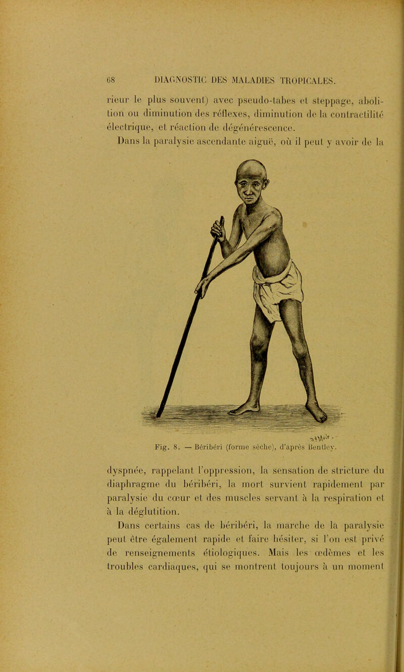 • T 08 DIAGNOSTIC DES MALADIES TROPICALES. rieur le plus souvent) avec pseudo-tabes et steppage, aboli- tion ou diminution des réflexes, diminution de la contractilité électrique, et réaction de dégénérescence. Dans la paralysie ascendante aiguë, où il peut y avoir de la dyspnée, rappelant l’oppression, la sensation de stricture du diaphragme du béribéri, la mort survient rapidement par paralysie du cœur et des muscles servant à la respiration et à la déglutition. Dans certains cas de béribéri, la marche de la paralysie peut être également rapide et faire hésiter, si l'on est privé de renseignements étiologiques. Mais les œdèmes et les troubles cardiaques, qui se montrent toujours à un moment