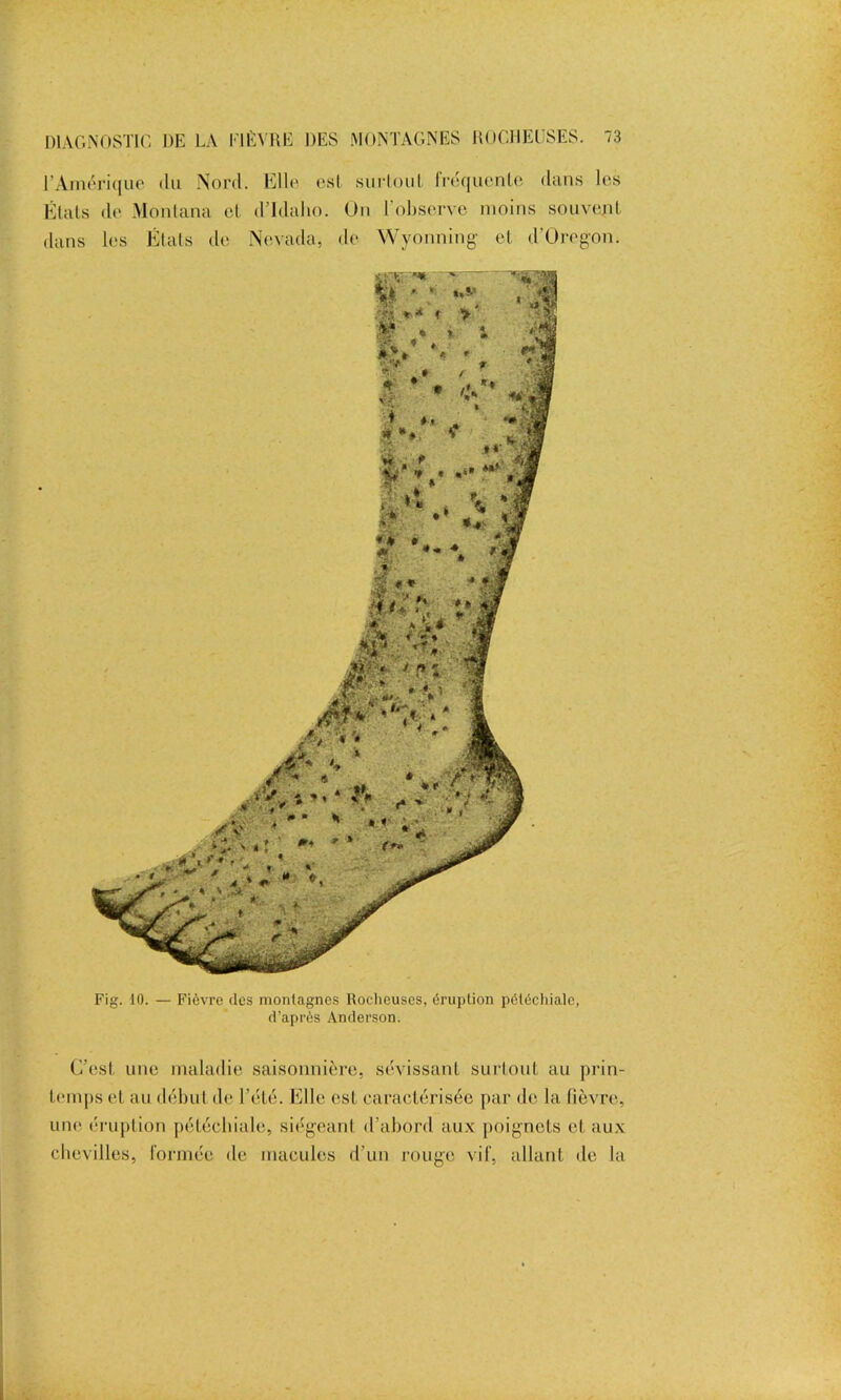 l’Amérique du Nord. Elle est .surtout fréquente dans les États de. Montana et d’Idalio. On l observe moins souvent dans les États de Nevada, de Wyonning et d’Oregon. Fig. 10. — Fièvre des montagnes Rocheuses, éruption pétéchiale, d’après Anderson. C’est une maladie saisonnière, sévissant surtout au prin- temps et au début de l’été. Elle est caractérisée par de la fièvre, une éruption pétéchiale, siégeant d’abord aux poignets et aux chevilles, formée de macules d’un rouge vif, allant de la