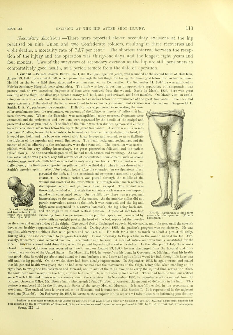 Secondary Excisions.—There were reported eleven secondary excisions at the hip practised on nine Union and two Confederate soldiers, resulting in three recoveries and eight deaths, a mortality rate of 72.7 per cent.1 The shortest interval between the recep- tion of the injury and the operation was thirty-one days, and the longest eight years and four months. Two of the survivors of secondary excision at the hip are still pensioners in comparatively good health, at a period remote from the date of operation. Case 261.—Private Joseph Brown, Co. I, 3d Michigan, aged 38 years, was wounded at the second battle of Bull Run, August 29, 1832, by a musket ball, which passed through the left thigh, fracturing the femur just below the trochanter minor. He laid on the battle field three days, and was then removed to Centreville. On September 11, 1862, he was admitted to Fairfax Seminary Hospital, near Alexandria. The limb was kept in position by appropriate apparatus; but suppuration was profuse, and, on two occasions, fragments of bone were removed from the wound. Early in March, 1883, there was great swelling of the thigh, the discharge became scanty and fetid, and pus burrowed amid the muscles. On March islst, an explo- ratory incision was made from three inches above to five inches below the prominence of the great trochanter. The neck and upper extremity of the shaft of the femur were found to be extensively diseased, and excision was decided on. Surgeon D. P. Smith, U. S. V., performed the operation. Difficulty was experienced in separating the mus- cular attachments from the trochanters, on account of the foliaceous masses of callus that had been thrown out. When this dissection was accomplished, many necrosed fragments were extracted, and the periosteum and new bone were separated by the handle of the scalpel and preserved as far as practicable. The shaft of the femur was then divided by powerful cutting bone forceps, about six inches below the tip of the great trochanter. A screw was driven into the mass of callus, below the trochanters, to be used as a lever in disarticulating the head, but it would not hold, and the bone was seized with large forceps and rotated, so as to facilitate the division of the capsular and round ligaments. The head, neck, and trochanters, and the masses of callus adhering to the trochanters, were then removed. The operation was accom- plished with but very trifling haemorrhage, yet great prostration followed, and the patient rallied slowly. As the anaesthesia passed off, he had much nausea and vomiting. As soon as this subsided, he was given a very full allowance of concentrated nourishment, such as strong beef-tea, eggs, milk, etc, with half an ounce of brandy every two hours. The wound was par- tially closed; the limb was supported on pillows until the third day, when it was dressed in a Smith’s anterior splint. About'forty-eight hours after the operation, an erysipelatous blush pervaded the limb, and the constitutional symptoms assumed a typhoid character. A female catheter was passed through the middle of the wound and another at its lower extremity, through which much ofl'ensive decomposed serum and grumous blood escaped. The wound was thoroughly washed out through the catheters with warm water impreg- nated with chlorinated soda. On the fifth day there was a rigor, and hsemorrhage to the extent of six ounces. As the anterior splint did not permit convenient access to the limb, it was removed, and the leg and thigh were suspended in a canvas hammock, the leg being horizontal andTrochTnVe^of^eft au<^ t^ie thigH in an almost vertical position. A piece of soft toweling femur, with foliaceous extending from the perinseum to the popliteal space, and, connected by cords with an upright post at the head of the bed, supported the muscles on the sides and under surface of the thigh. The wound freely discharged synovia, bloody serum, and thin pus, until the seventh day, when healthy suppuration was fairly established. During April, 1863, the patient's progress was satisfactory. He was supplied with very nutritious diet, with porter, and cod-liver oil. He took for a time as much as a half a pint of oil daily. During May, the case continued to progress favorably. It was necessary to keep a tube in the wound until June 1st. Pre- viously, whenever it was removed pus would accumulate and burrow. A mesh of suture wire was finally substituted for the tube. Thi was retained until J une 20th, when the patient began to get about on crutches. In the latter part of J uly the wounds closed. In August, Brown was reported as “well,” and on August 23, 1863, he was discharged from the hospital and from the military service of the United States. On March 21,1864, he wrote from his home in Coopersville, Michigan, that his health was good; that he could get about and attend to home business; could saw and split a little wood for fuel, though his knee was stiff and his leg painful. On the whole, there had been steady improvement. In September, 1833, he again wrote, and stated that his general health was good; that he had some control over the movements of the thigh, being able, when standing on the right foot, to swing the left backward and forward, and to adduct the thigh enough to carry the injured limb across the other. He could bear some weight on the limb, and use but one crutch, with a stirrup for the foot. There had been no fistulous orifices since March 1864, and there was no soreness about the cicatrices. In November, 1865, in accordance with a request from the Surgeon General’s Office, Mr. Brown had a photograph (Fig. 69) taken to represent the amount of deformity in his limb. This picture is numbered 110 in the Photograph Series of the Army Medical Museum. It is carefully copied in the accompanying wood-cut. The excised bone is preserved at the Museum, and is numbered 1192, Section I. It is represented in the adjacent wood-cut (Fig. 68). On February 12, 1868, he wrote to the compiler of this report: “I take pleasure in informing you that my ‘Besides the nine cases recorded in the Report on Excisions of the Bead of the Femur for Gunshot Injury, S. G. O., 1869, a successful exantple has been reported by Dr. E. STEitLING, of Cleveland, Ohio, and another successful operation was performed in 1871, by Dr. J. iv. BIGELOW of Indianapolis. SURG. Ill—15