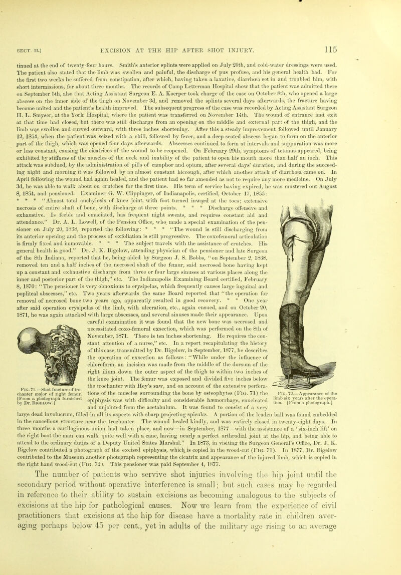 tinued at the end of twenty-four hours. Smith’s anterior splints were applied on July 20th, and cold-water dressings were used. The patient also stated that the limb was swollen and painful, the discharge of pus profuse, and his general health bad. For the first two weeks he suffered from constipation, after which, having taken a laxative, diarrhoea set in and troubled him, with short intermissions, for about three months. The records of Camp Letterman Hospital show that the patient was admitted there on September 5th, also that Acting Assistant Surgeon E. A. Koerper took charge of the case on October 8th, who opened a large abscess on the inner side of the thigh on November 3d, and removed the splints several days afterwards, the fracture having become united and the patient’s health improved. The subsequent progress of the case was recorded by Acting Assistant Surgeon H. L. Smyser, at the York Hospital, where the patient was transferred on November 14th. The wound of entrance ana exit at that time had closed, but there was still discharge from an opening on the middle and external part of the thigh, and the limb was swollen and curved outward, with three inches shortening. After this a steady improvement followed until January 12, 1834, when the patient was seized with a chill, followed by fever, and a deep seated abscess began to form on the anterior part of the thigh, which was opened four days afterwards. Abscesses continued to form at intervals and suppuration was more or less constant, causing the cicatrices of the wound to be reopened. On February 29th, symptoms of tetanus appeared, being exhibited by stiffness of the muscles of the neck and inability of the patient to open his mouth more than half an inch. This attack was subdued, by the administration of pills of camphor and opium, after several days’ duration, and during the succeed- ing night and morning it was followed by an almost constant hiccough, after which another attack of diarrhoea came on. In April following the wound had again healed, and the patient had so far amended as not to require any more medicine. On July 3d, he was able to walk about on crutches for the first time. His term of service having expired, he was mustered out August 8, 1834, and pensioned. Examiner G. W. Clippinger, of Indianapolis, certified, October 17, 1833: * * * “Almost total anchylosis of knee joint, with foot turned inward at the toes; extensive necrosis of entire shaft of bone, with discharge at three points. * * * Discharge offensive and exhaustive. Is feeble and emaciated, has frequent night sweats, and requires constant aid and attendance.” Dr. A. L. Lowell, of the Pension Office, who made a special examination of the pen- sioner on July 20, 1868, reported the following: * * * ‘‘The wound is still discharging from its anterior opening and the process of exfoliation is still progressive. The coxofemoral articulation is firmly fixed and immovable. * * * The subject travels with the assistance of crutches. His general health is good.” Dr. J. K. Bigelow, attending physician of the pensioner and late Surgeon of the 8tli Indiana, reported that he, being aided by Surgeon J. S. Bobbs, “on September 2, 1888, removed ten and a half inches of the necrosed shaft of the femur, said necrosed bone having kept up a constant and exhaustive discharge from three or four large sinuses at various places along the inner and posterior part of the thigh,” etc. The Indianapolis Examining Board certified, February 8, 1870: “The pensioner is very obnoxious to erysipelas, which frequently causes large inguinal and popliteal abscesses,” etc. Two years afterwards the same Board reported that “the operation for removal of necrosed bone two years ago, apparently resulted in good recovery. * * One year after said operation erysipelas of the limb, with ulceration, etc., again ensued, and on October 20, 1871, he was again attacked with large abscesses, and several sinuses made their appearance. Upon careful examination it was found that the new bone was necrosed and necessitated coxo-femoral exsection, which was performed on the 8th of November, 1871. There is ten inches shortening. He requires the con- stant attention of a nurse,” etc. In a report recapitulating the history of this case, transmitted by Dr. Bigelow, in September, 1877, lie describes the operation of exsection as follows: “While under the influence of chloroform, an incision was made from the middle of the dorsum of the right ilium down the outer aspect of the thigh to within two inches of the knee joint. The femur was exposed and divided five inches below the trochanter with Iley’s saw, and on account of the extensive perfora- tions of the muscles surrounding the bone by osteophytes (Fig. 71) the epiphysis was with difficulty and considerable haemorrhage, enucleated and unjointed from the acetabulum. It was found to consist of a very large dead involucrum, filled in all its aspects with sharp projecting spicules. A portion of the leaden ball was found embedded in the cancellous structure near the trochanter. The wound healed kindly, and was entirely closed in twenty-eight days. In three months a cartilaginous union had taken place, and now—in September, 1877—with the assistance of a 'six-incli lift’ on the right boot the man can walk quite well with a cane, having nearly a perfect arthrodial joint at the hip, and being able to attend to the ordinary duties of a Deputy United States Marshal.” In 1873, in visiting the Surgeon General’s Office, Dr. J. K. Bigelow contributed a photograph of the excised epiphysis, which is copied in the wood-cut (Fig. 71). In 1877, Dr. Bigelow contributed to the Museum another photograph representing the cicatrix and appearance of the injured limb, which is copied in the right hand wood-cut (Fig. 72). This pensioner was paid September 4, 1877. The number ot' patients who servive shot injuries involving the hip joint, until the secondary period without operative interference is small; but such cases may be regarded in reference to their ability to sustain excisions as becoming analogous to the subjects of excisions at the hip for pathological causes. Now we learn from the experience of civil practitioners that excisions at the hip for disease have a mortality rate in children aver- aging perhaps below 45 per cent., yet in adults of the military age rising to an average Fig. 71.—Shot fracture of tro- chanter major of right femur. fFrom a photograph furnished by Dr. BIGELOW.] FIG. 72.—Appearance of the limb six years after the opera- tion. [From a photograph.]