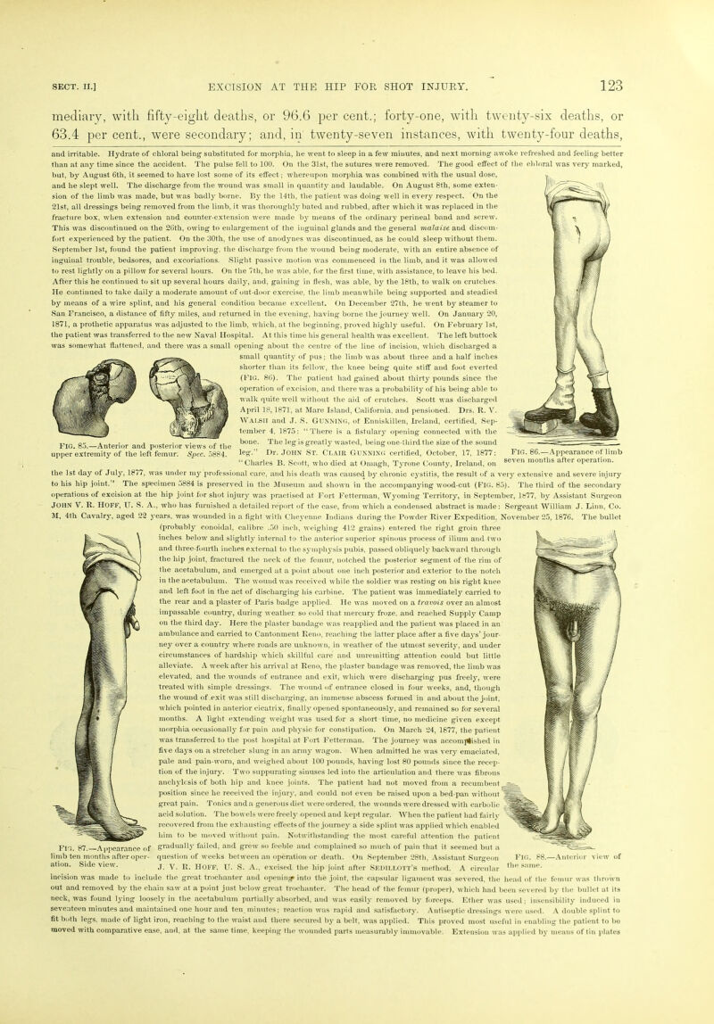 mediary, with fifty-eight deaths, or 96.6 per cent.; forty-one, with twenty-six deaths, or 63.4 per cent., were secondary; and, in twenty-seven instances, with twenty-four deaths, FIG. 85.—Anterior and posterior views of the upper extremity of the left femur. Spec. 5884. and irritable. Hydrate of chloral being substituted for morphia, he went to sleep in a few minutes, and next morning awoke refreshed and feeling better than at any time since the accident. The pulse fell to 100. On the 31st, the sutures were removed. The good effect of the chloral was very marked, but, by August 6th, it seemed to have lost some of its effect; whereupon morphia was combined with the usual dose, and he slept well. The discharge from the wound was small in quantity and laudable. On August 8th, some exten- sion of the limb was made, but was badly borne. By the 14th, the patient was doing well in every respect. On the 21st, all dressings being removed from the limb, it was thoroughly bated and rubbed, after which it was replaced in the fracture box, when extension and counter-extension were made by means of the ordinary perineal band and screw. This was discontinued on the 26th, owing to enlargement of the inguinal glands and the general malaise and discom- fort experienced by the patient. On the 30th, the use of anodynes was discontinued, as he could sleep without them. September 1st, found the patient improving, the discharge from the wound being moderate, with an entire absence of inguinal trouble, bedsores, and excoriations. Slight passive motion was commenced in the limb, and it was allowed to rest lightly on a pillow for several hours. On the 7th, he was able, for the first time, with assistance, to leave his bed. After this he continued to sit up several hours daily, and, gaining in flesh, was able, by the 18th, to walk on crutches. He continued to take daily a moderate amount of out door exercise, the limb meanwhile being supported and steadied by means of a wire splint, and his general condition became excellent. On December 27th, he went by steamer to San Francisco, a distance of fifty miles, and returned in the evening, having borne the journey well. On January 20, 1871, a prothetic apparatus was adjusted to the limb, which, at the beginning, proved highly useful. On February 1st, the patient was transferred to the new Naval Hospital. At this time his general health was excellent. The left buttock was somewhat flattened, and there was a small opening about the centre of the line of incision, which discharged a small quantity of pus; the limb was about three and a half inches shorter than its fellow, the knee being quite stiff and foot everted (FIG. 86). The patient had gained about thirty pounds since the operation of excision, and there was a probability of his being able to walk quite well without the aid of crutches. Scott was discharged April 18,1871, at Mare Island, California, and pensioned. Drs. R. V. Walsii and J. S. GUNNING, of Enniskillen, Ireland, certified, Sep- tember 4. 1875: “There is a fistulary opening connected with the bone. The leg is greatly wasted, being one-third the size of the sound leg.” Dr. John St. Clair Gunning certified, October, 17, 1877: Fig. 86.—Appearance of limb “ Charles B. Scott, who died at Omagh, Tyrone County, Ireland, on seven months after operation, the 1st day of July, 1877, was under my professional care, and his death was caused by chronic cystitis, the result of a very extensive and severe injury to his hip joint.” The specimen 5884 is preserved in the Museum and shown in the accompanying wood-cut (FIG. 85). The third of the secondary operations of excision at the hip joint for shot injury was practised at Fort Fetterman, Wyoming Territory, in September, 1877, by Assistant Surgeon JOHN V. R. HOFF, U. S. A., who has furnished a detailed report of the case, from which a condensed abstract is made: Sergeant William J. Linn, Co. M, 4th Cavalry, aged 22 years, was wounded in a fight with Cheyenne Indians during the Powder River Expedition. November 25, 1876. The bullet (probably conoidal, calibre .50 inch, weighing 412 grains) entered the right groin three inches below and slightly internal to the anterior superior spinous process of ilium and two and three-fourth inches external to the symphysis pubis, passed obliquely backward through the hip joint, fractured the neck of the femur, notched the posterior segment of the rim of the acetabulum, and emerged at a point about one inch posterior and exterior to the notch in the acetabulum. The wound was received while the soldier was resting on his right knee and left foot in the act of discharging his carbine. The patient was immediately earned to the rear and a plaster of Paris badge applied. He was moved on a travois over an almost impassable country, during weather so cold that mercury froze, and reached Supply Camp on the third day. Here the plaster bandage was reapplied and the patient was placed in an ambulance and carried to Cantonment Reno, reaching the latter place after a five days’ jour- ney over a country where roads are unknown, in weather of the utmost severity, and under circumstances of hardship which skillful care and unremitting attention could but little alleviate. A week after his arrival at Reno, the plaster bandage was removed, the limb was elevated, and the wounds of entrance and exit, which were discharging pus freely, were treated with simple dressings. The wound of entrance closed in four weeks, and, though the wound of .exit was still discharging, an immense abscess formed in and about the joint, which pointed in anterior cicatrix, finally opened spontaneously, and remained so for several months. A light extending weight was used for a short time, no medicine given except morphia occasionally for pain and physic for constipation. On March 24, 1877, the patient was transferred to the post hospital at Fort Fetterman. The journey was accomplished in five da}'s on a stretcher slung in an army wagon. When admitted he was very emaciated, pale and pain-worn, and weighed about 100 pounds, having lost 80 pounds since the recep- tion of the injury. Two suppurating sinuses led into the articulation and there was fibrous anchylosis of both hip and knee joints. The patient had not moved from a recumbent position since he received the injury, and could not even be raised upon a bed-pan without great pain. Tonics and a generous diet were ordered, the wounds were dressed with carbolic acid solution. The bowels were freely opened and kept regular. When the patient had fairly recovered from the exhausting effects of the journey a side splint was applied which enabled him to be moved without pain. Notwithstanding the most careful attention the patient Fig. 87. Appearance of gradually tailed, and grew so feeble and complained so much of pain that it seemed but a limb ten months after oper- question of weeks between an operation or death. On September 28th. Assistant Surgeon ation. Side view. J. V. R. IIOFF. U. S. A., excised, the hip joint after Siodillott’s method. A circular same* incision was made to include the great trochanter and opening into the joint, the capsular ligament was severed, the head of the femur was thrown out and removed by the chain saw at a point just below great trochanter. The head of the femur (proper), which had been severed by the bullet at its neck, was found lying loosely in the acetabulum partially absorbed, and was easily removed by forceps. Ether was used; insensibility induced iu seventeen minutes and maintained one hour and ten minutes; reaction was rapid and satisfactory. Antiseptic dressings were used. A double splint to fit both legs, made of light iron, reaching to the waist and there secured by a belt, was applied. This proved most useful in enabling the patient to be moved with comparative ease, and. at the same time, keeping the wounded parts measurably immovable. Extension was applied by means of tin plates Fig. 88.—Anterior view of