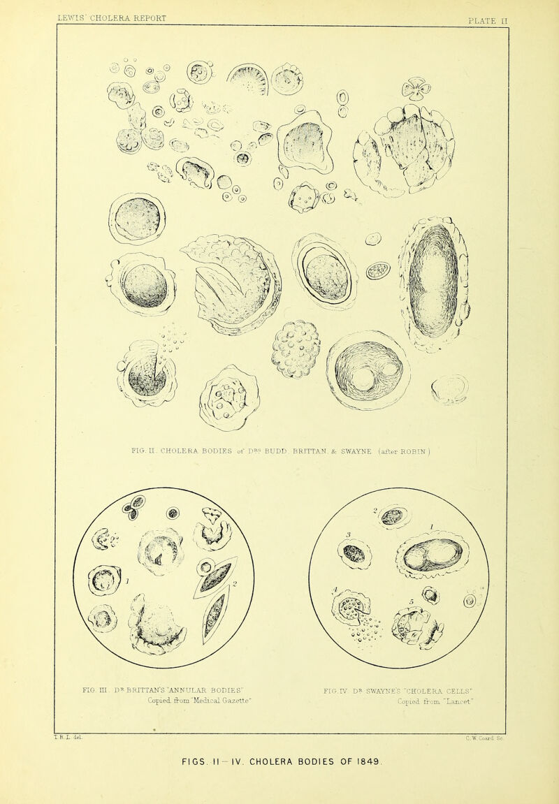 PLATE II FI&. II. CHOLERA BODIES of D?? BUDD, BRITTAN. & SAMAYKE (ailer ROBIN ) FIG. EU. DIBRITTAN'S ANNULAR BODIES FIG.TV. D? SWAYNE'S CHOLERA CELLS Copied fTomMeclical Gazette Copied from. Laru'et' T.E L. del. C. W. Coal’d Sc. FIGS. II-IV. CHOLERA BODIES OF 1849.