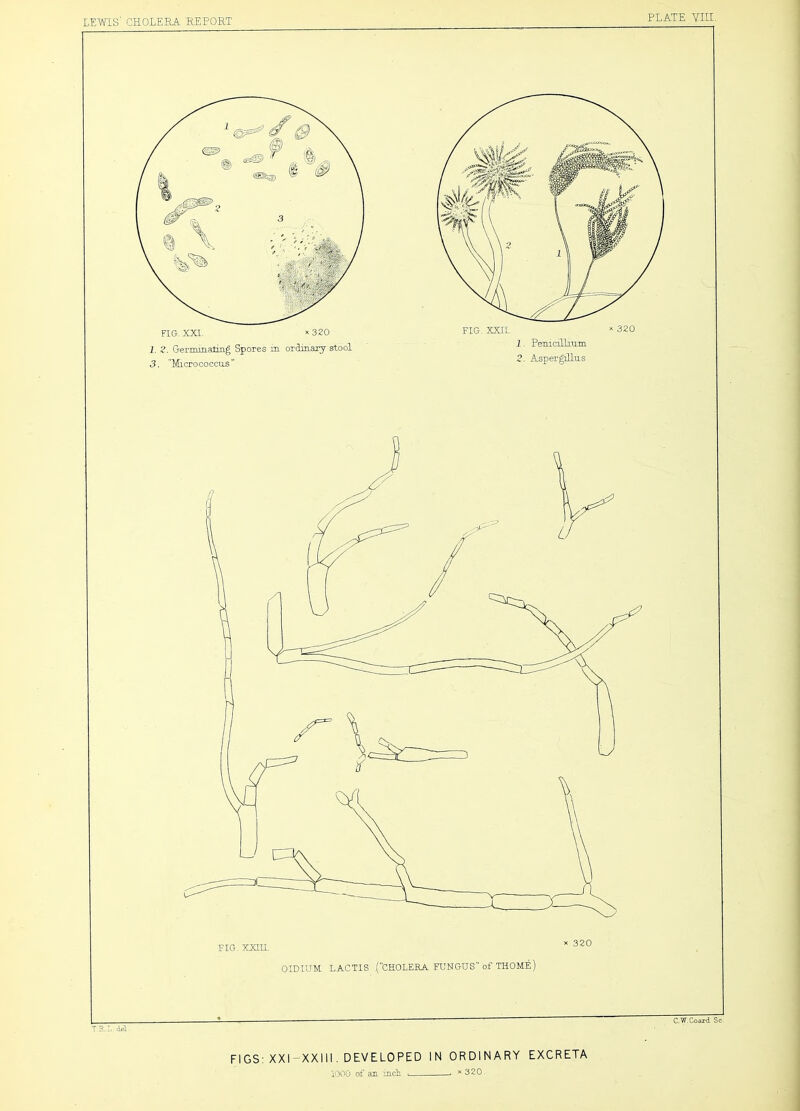 PLATE YIII. FIG. XXI. »320 I. ?. Germmaliiig Spores in orlniaTy stool 3. Microcoocu-s'' OIDIUM LACTIS (CHOLERA FUNGUS of THOME) FIGS: XXHXXIII. DEVELOPED IN ORDINARY EXCRETA iOOO of an inch. • 320. I TR..L.dii- C.'W.Coard Sc.